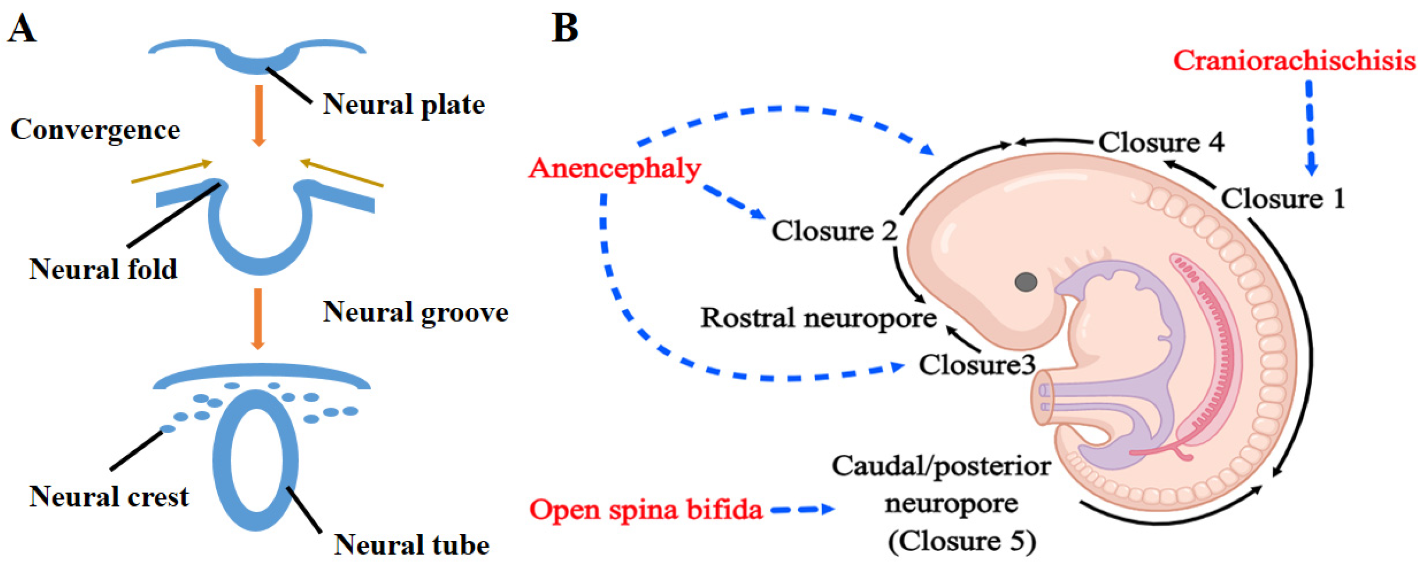 IJMS Free FullText Neural Tube Defects and Folate Deficiency Is