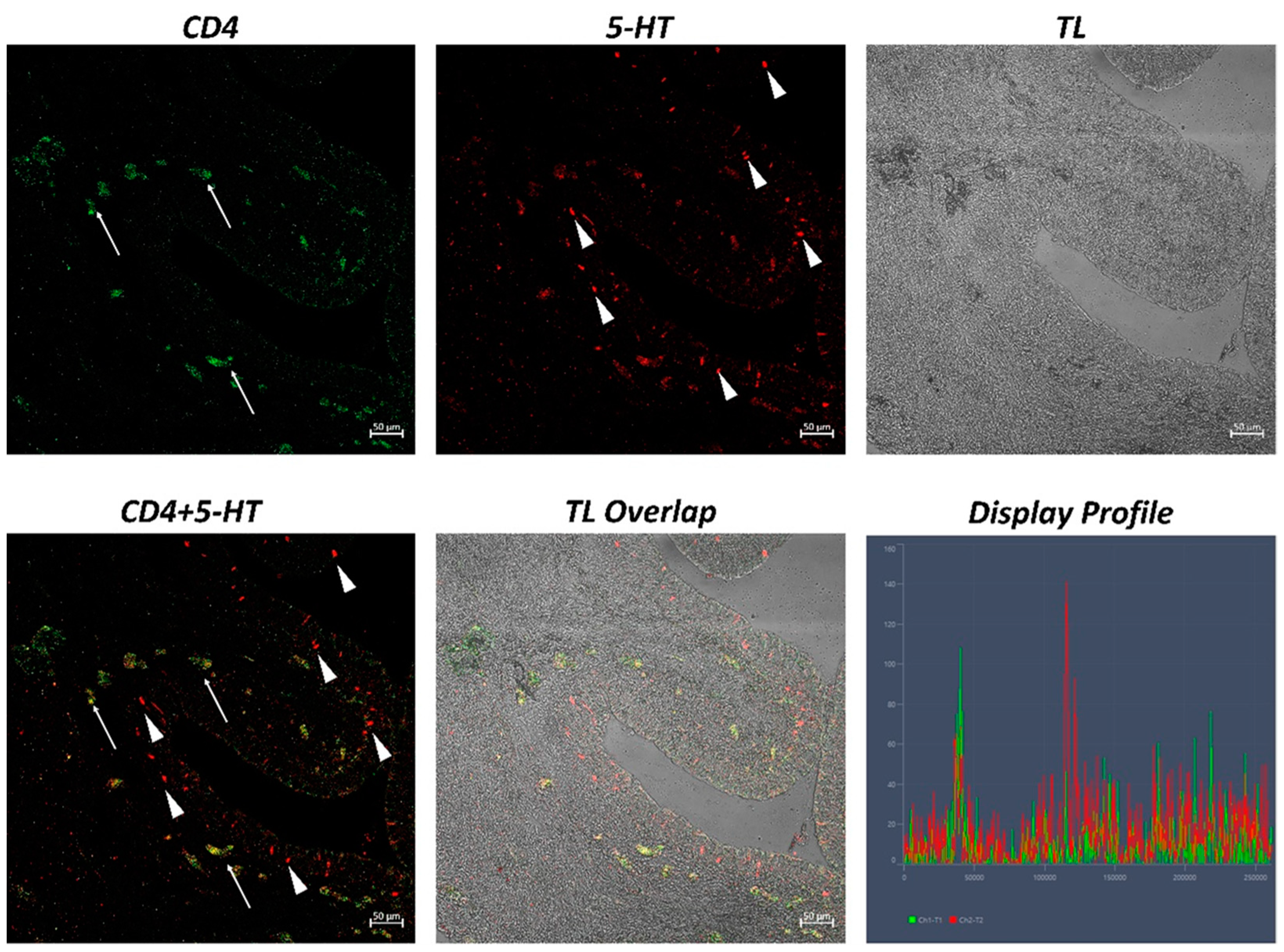 Ijms 24 02316 g005 Ijms 24 02316 g005