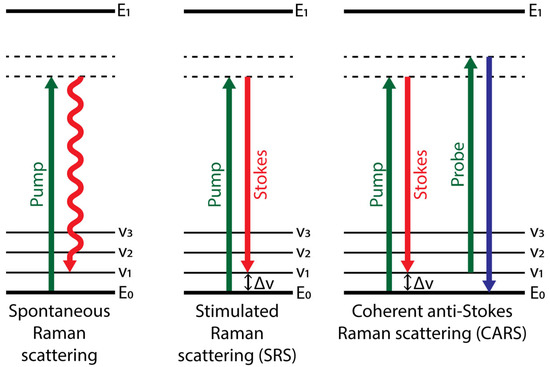 Raman Spectroscopy as a Tool to Study the Pathophysiology of Brain Diseases