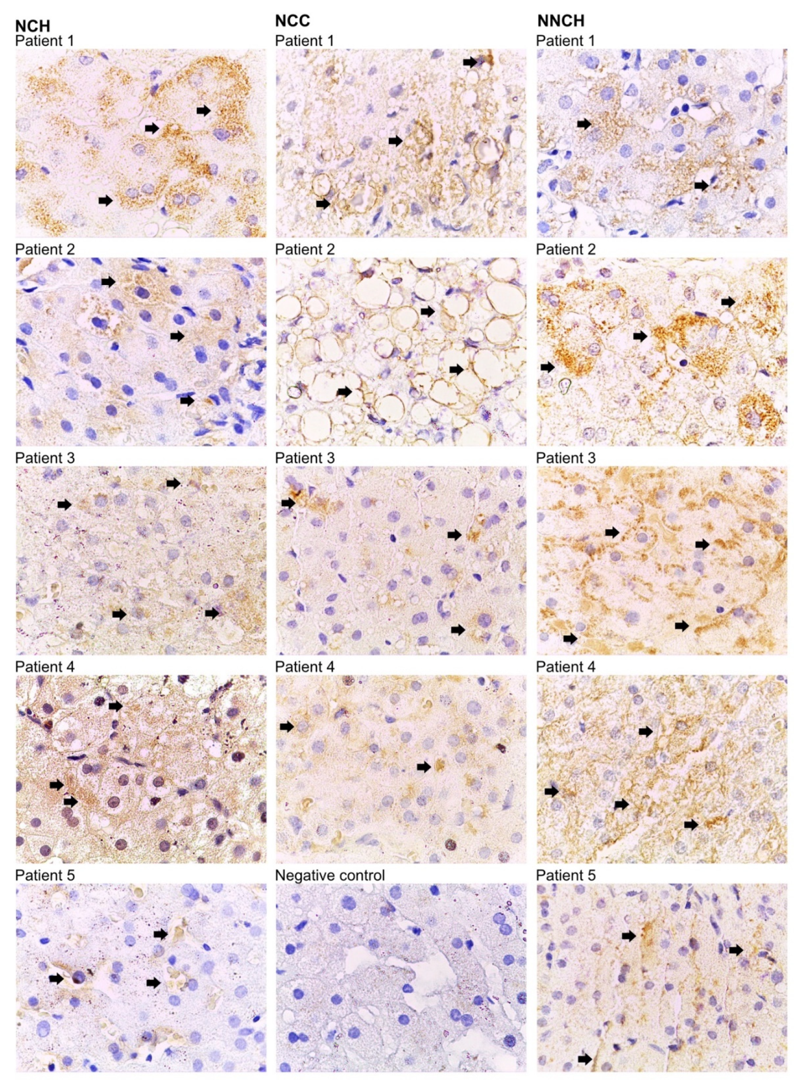 Ijms 24 02485 g002 Ijms 24 02485 g002