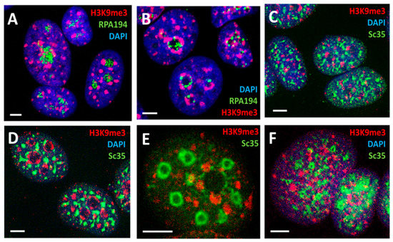 Spatial-Temporal Genome Regulation in Stress-Response and