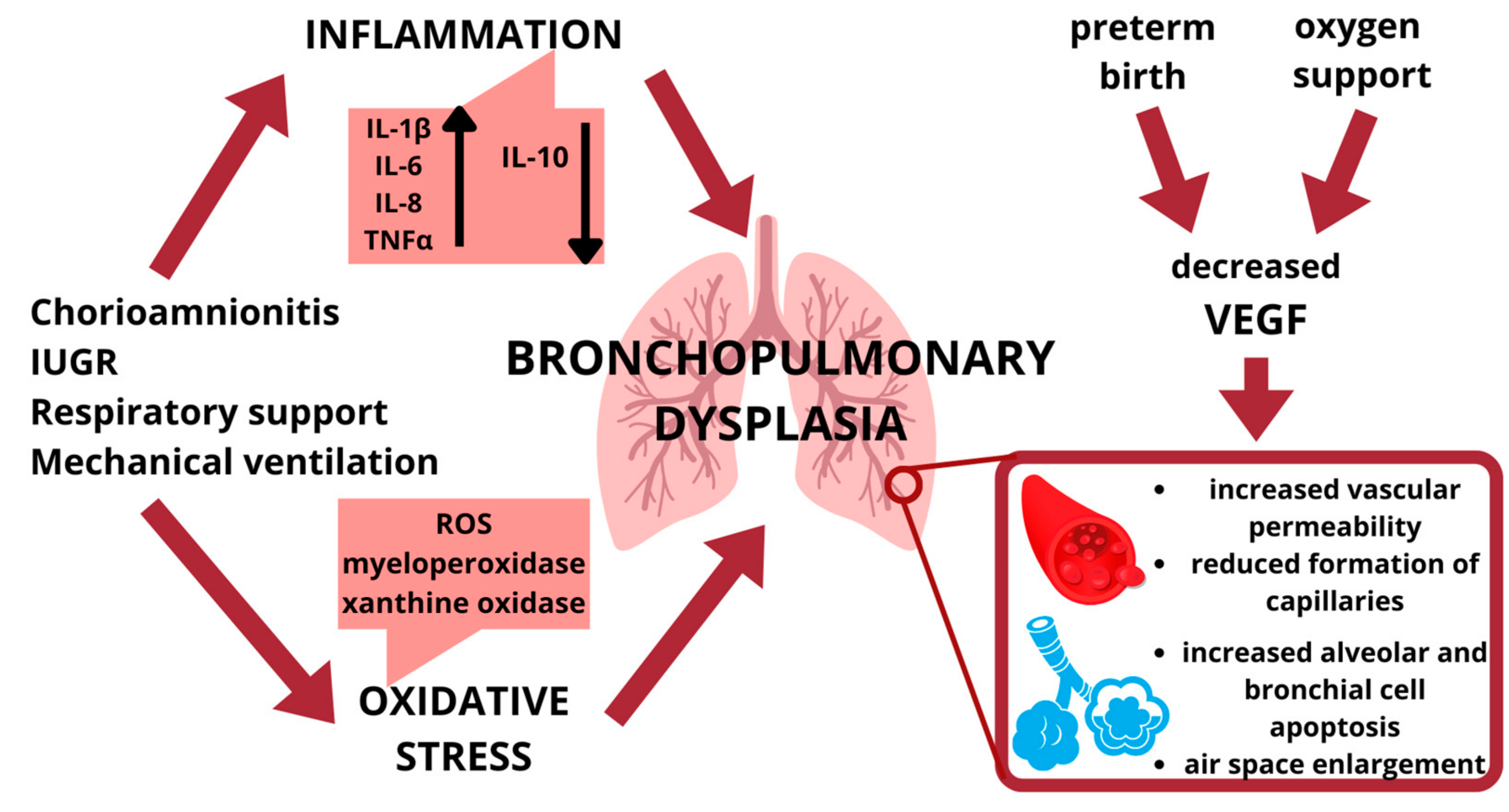 Bronchopulmonary dysplasia bpd 