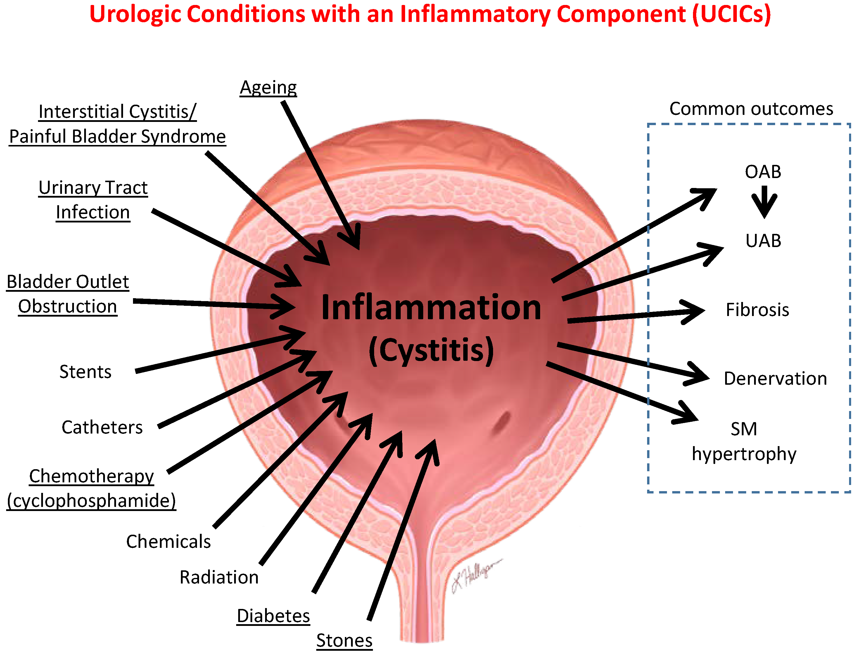 IJMS Free Full Text Why Are Some People With Lower Urinary Tract ijms-free-full-text-why-are-some-people-with-lower-urinary-tract