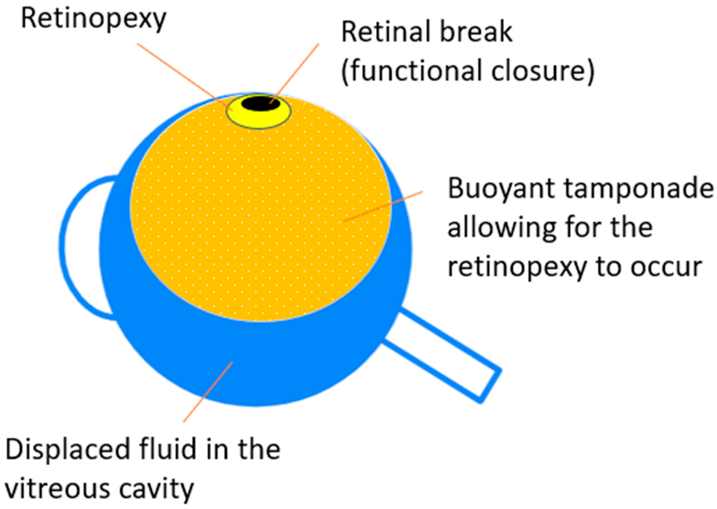 The future of vision and eye care - Hunimed