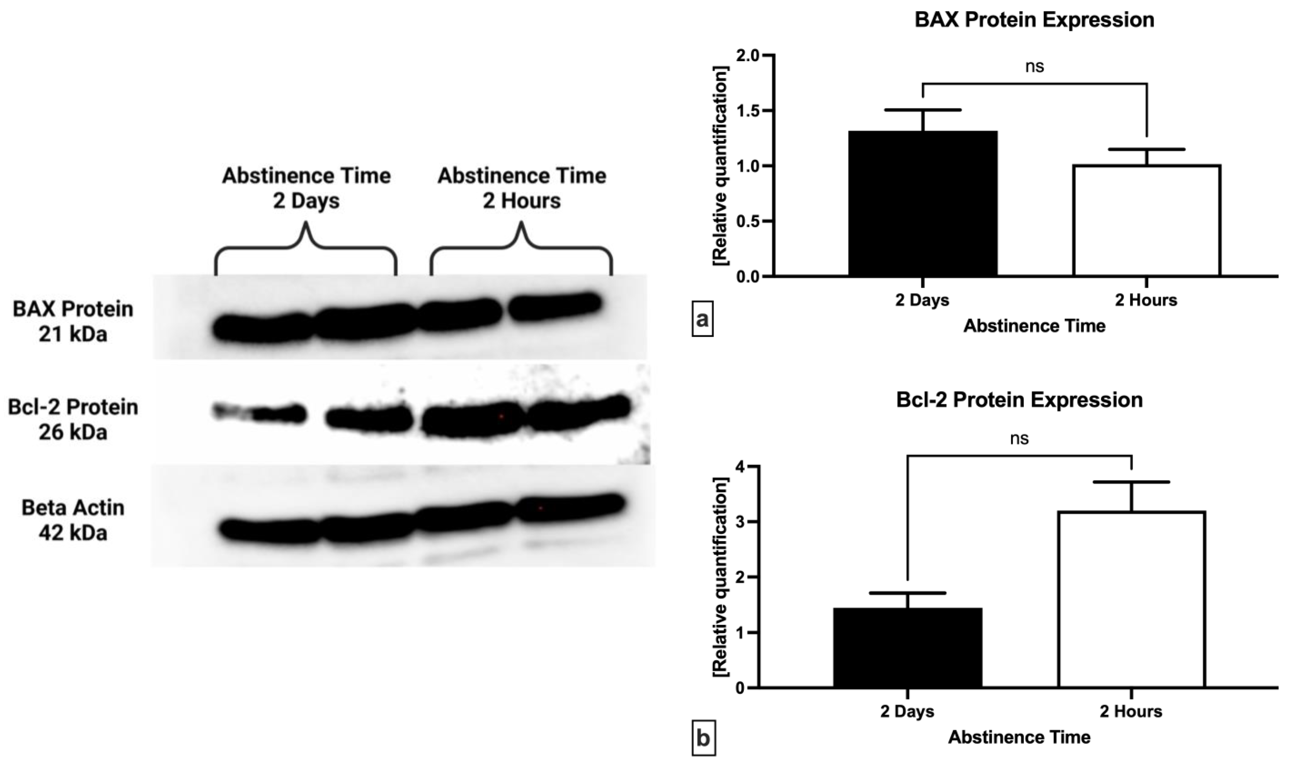 IJMS Free FullText Ejaculatory Abstinence Affects the Sperm