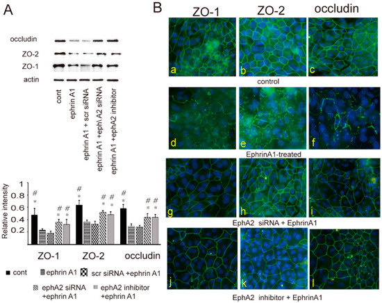 The EphA1 and EphA2 Signaling Modulates the Epithelial