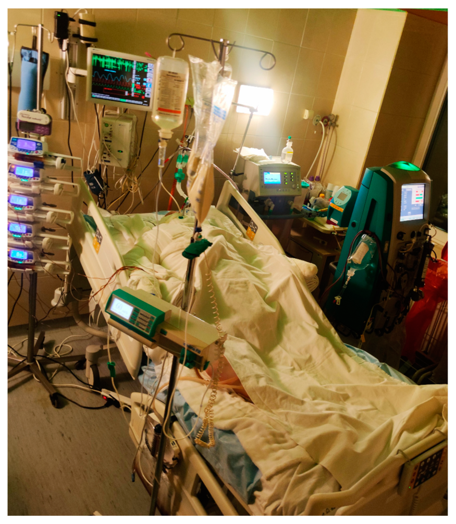 Burns: Classification, Pathophysiology, and Treatment: A Review
