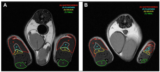 リラクゼーション セパレートポール – リラクシングワーク 公式オンラインストア