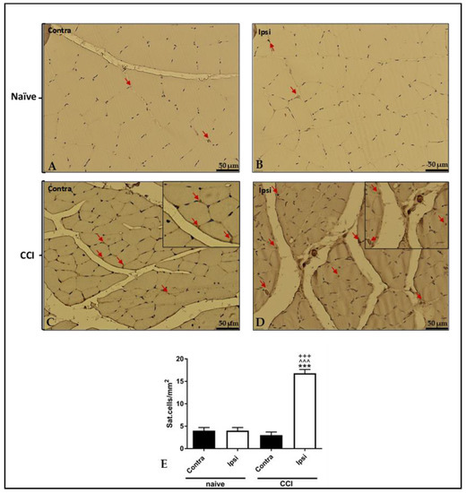 Pathophysiological Aspects of Muscle Atrophy and Osteopenia