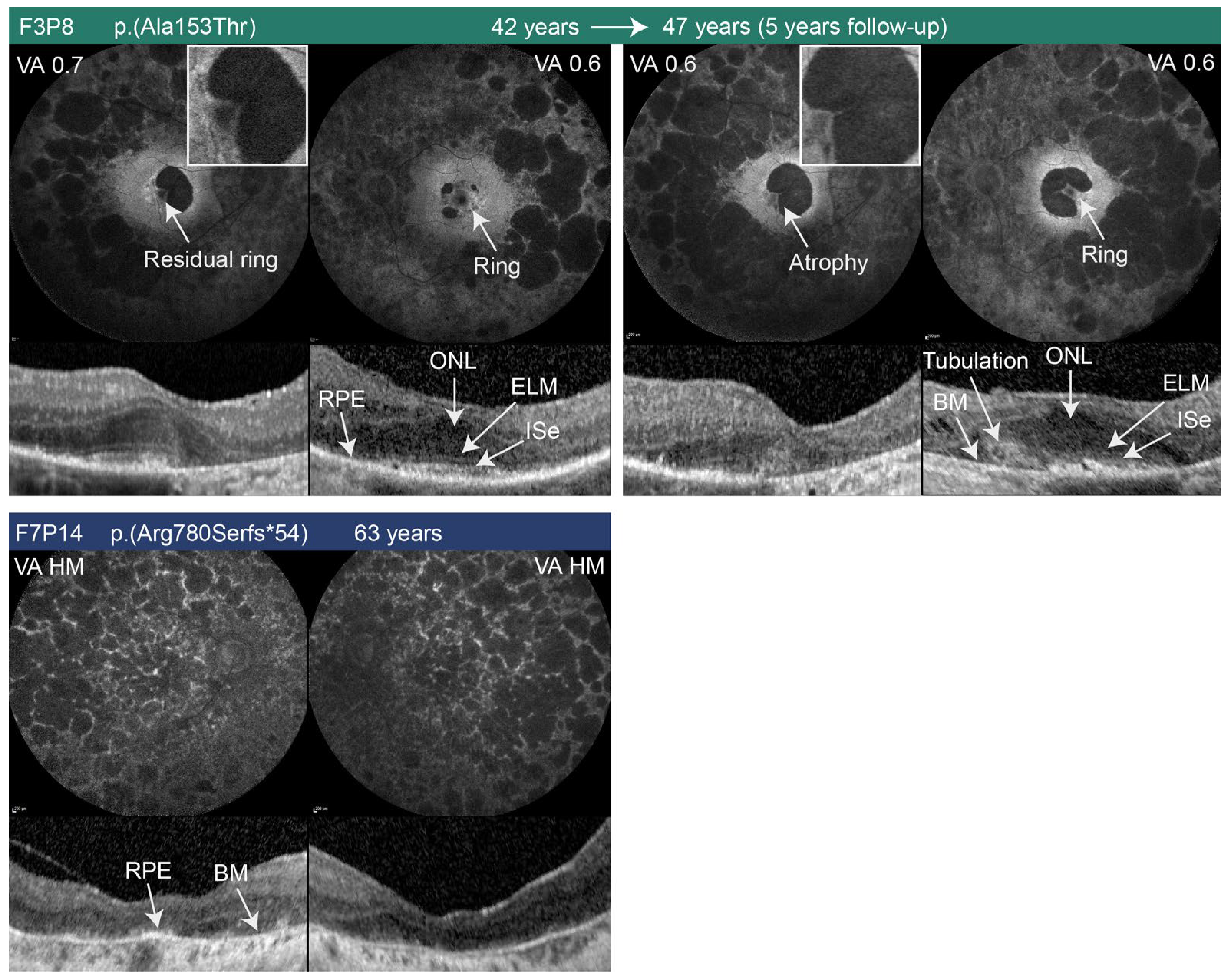 Ijms 24 03840 g004 Ijms 24 03840 g004