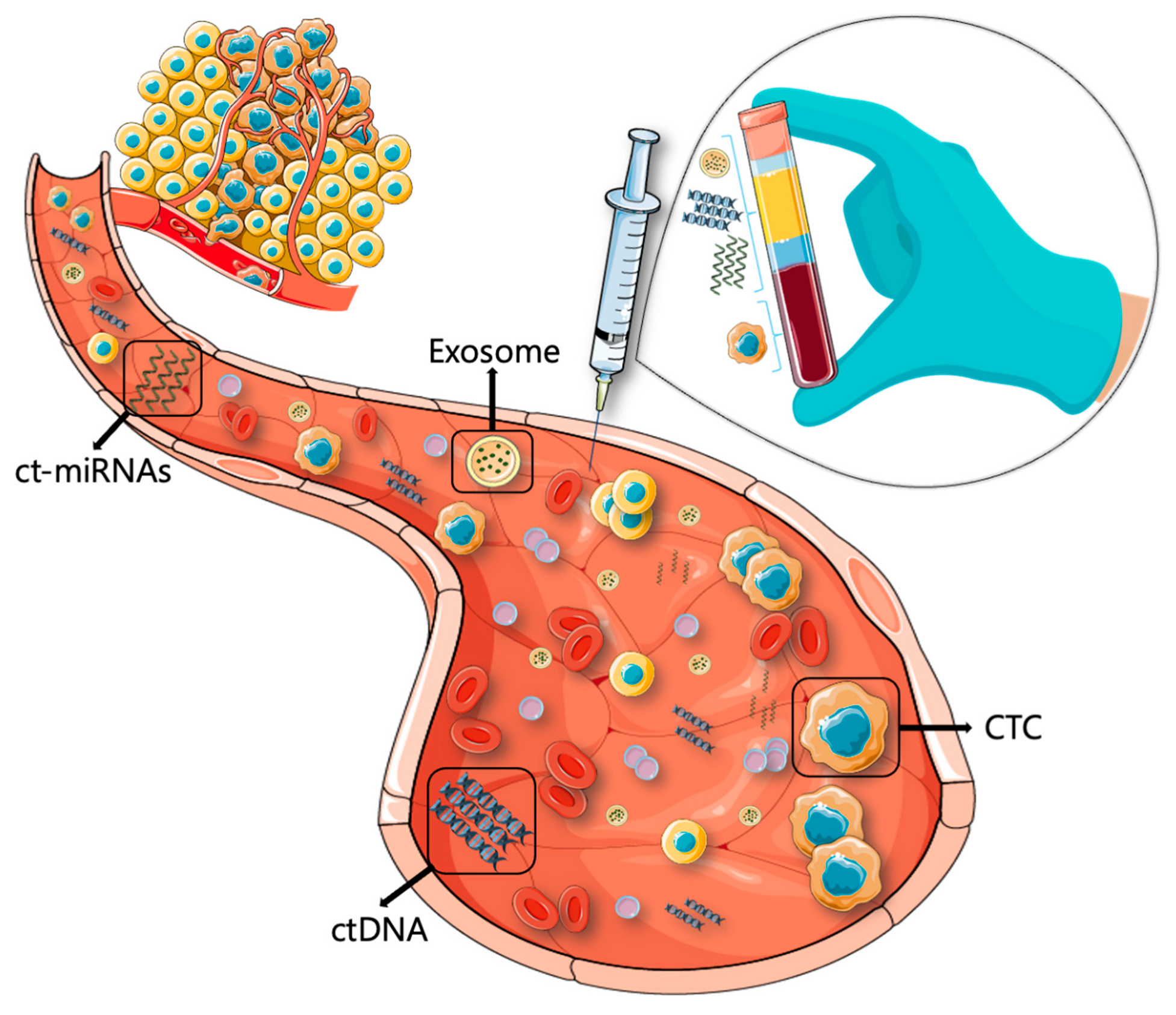 IJMS Free FullText Metastatic Melanoma Liquid Biopsy as a New