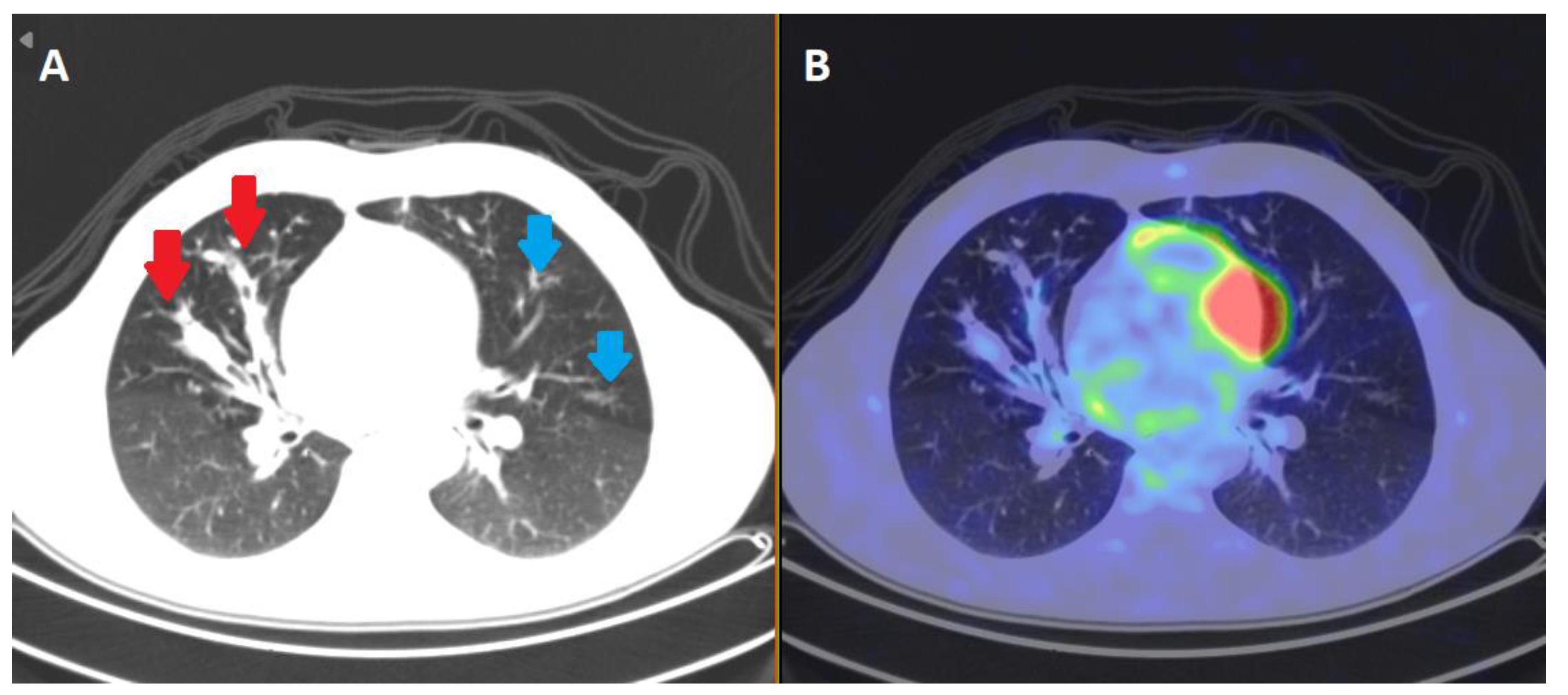 Ijms 24 04052 g001 Ijms 24 04052 g001