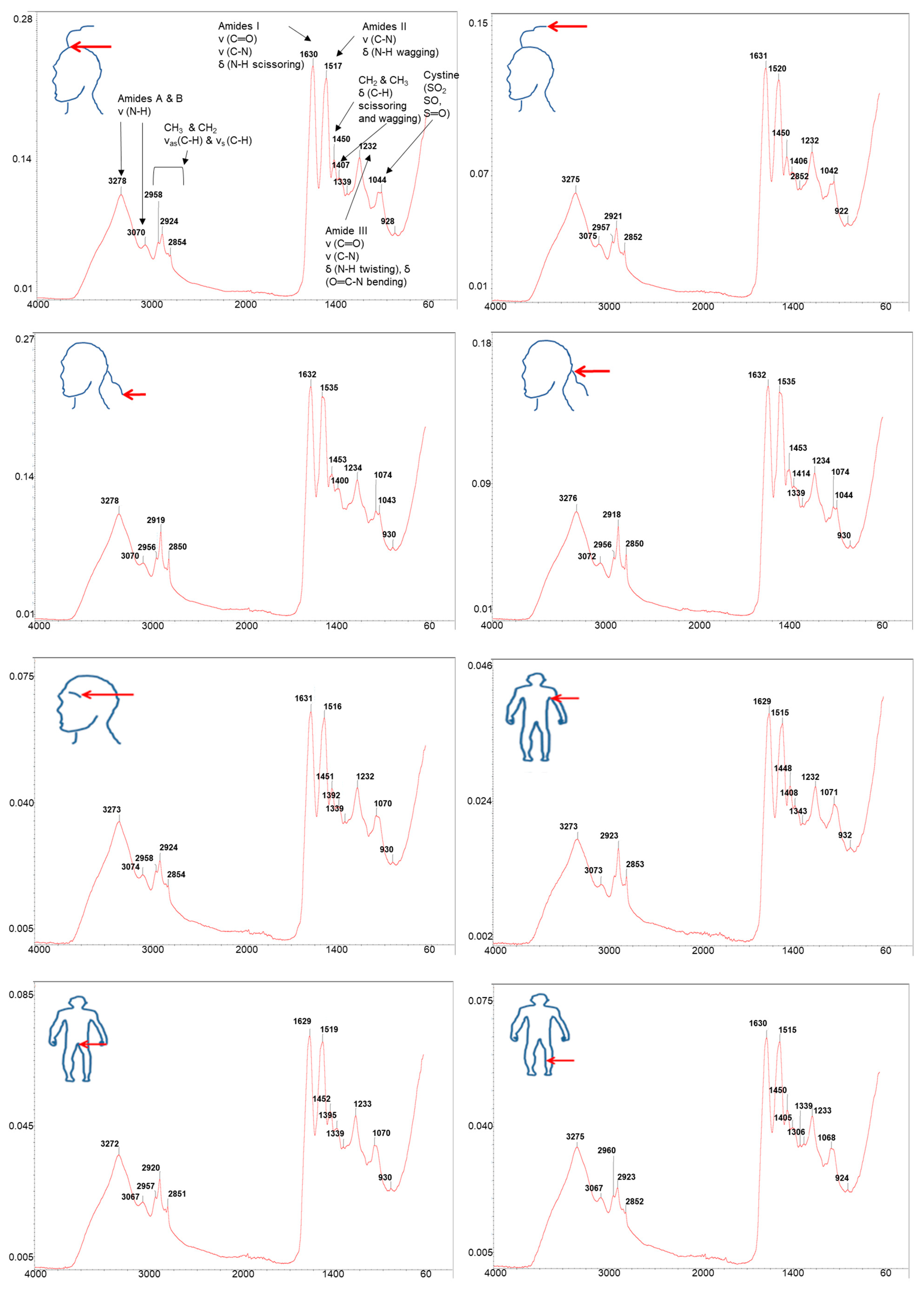 Ijms 24 04166 g004 Ijms 24 04166 g004