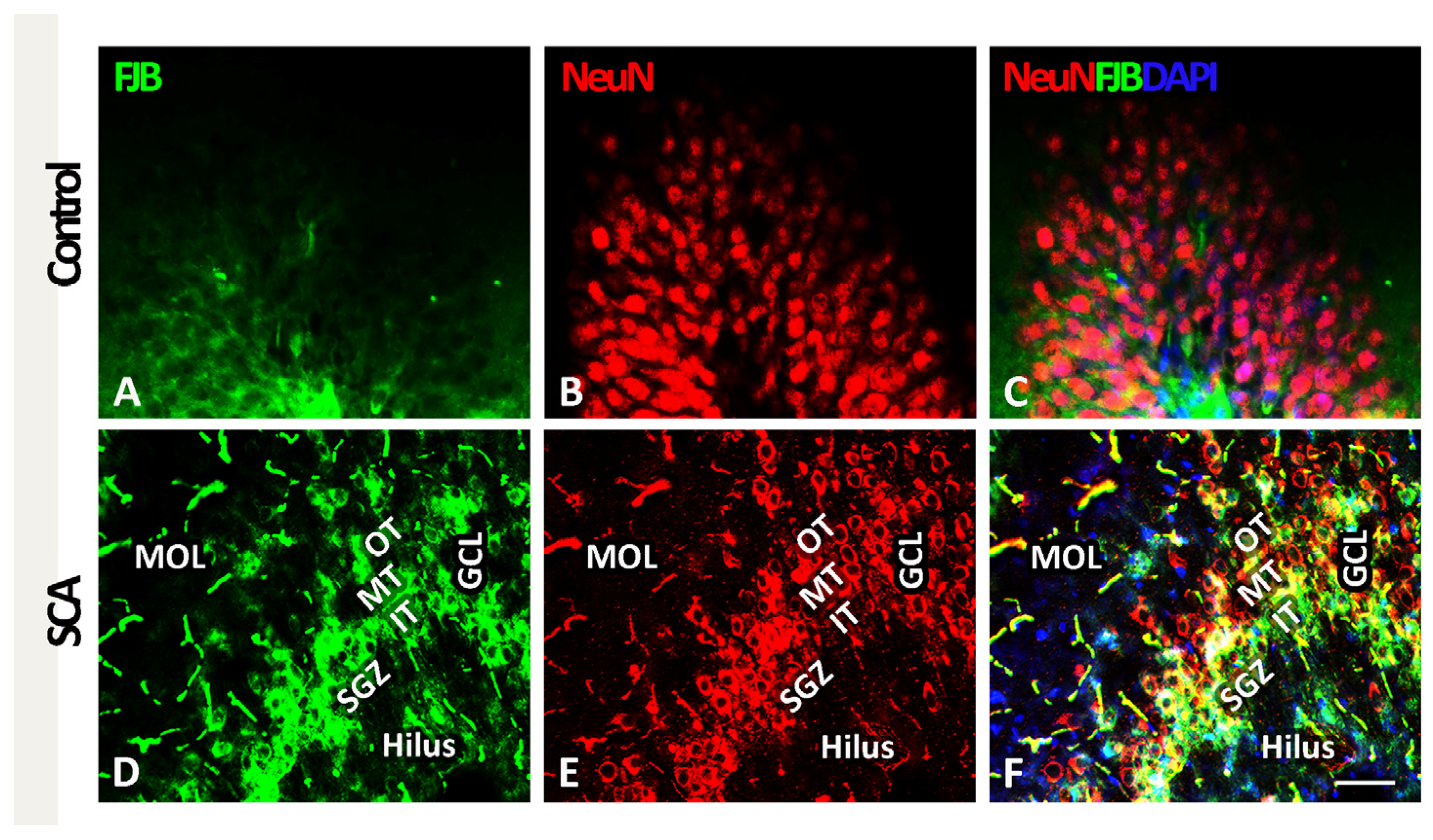 Hyperbaric Oxygenation Prevents Loss of Immature Neurons in