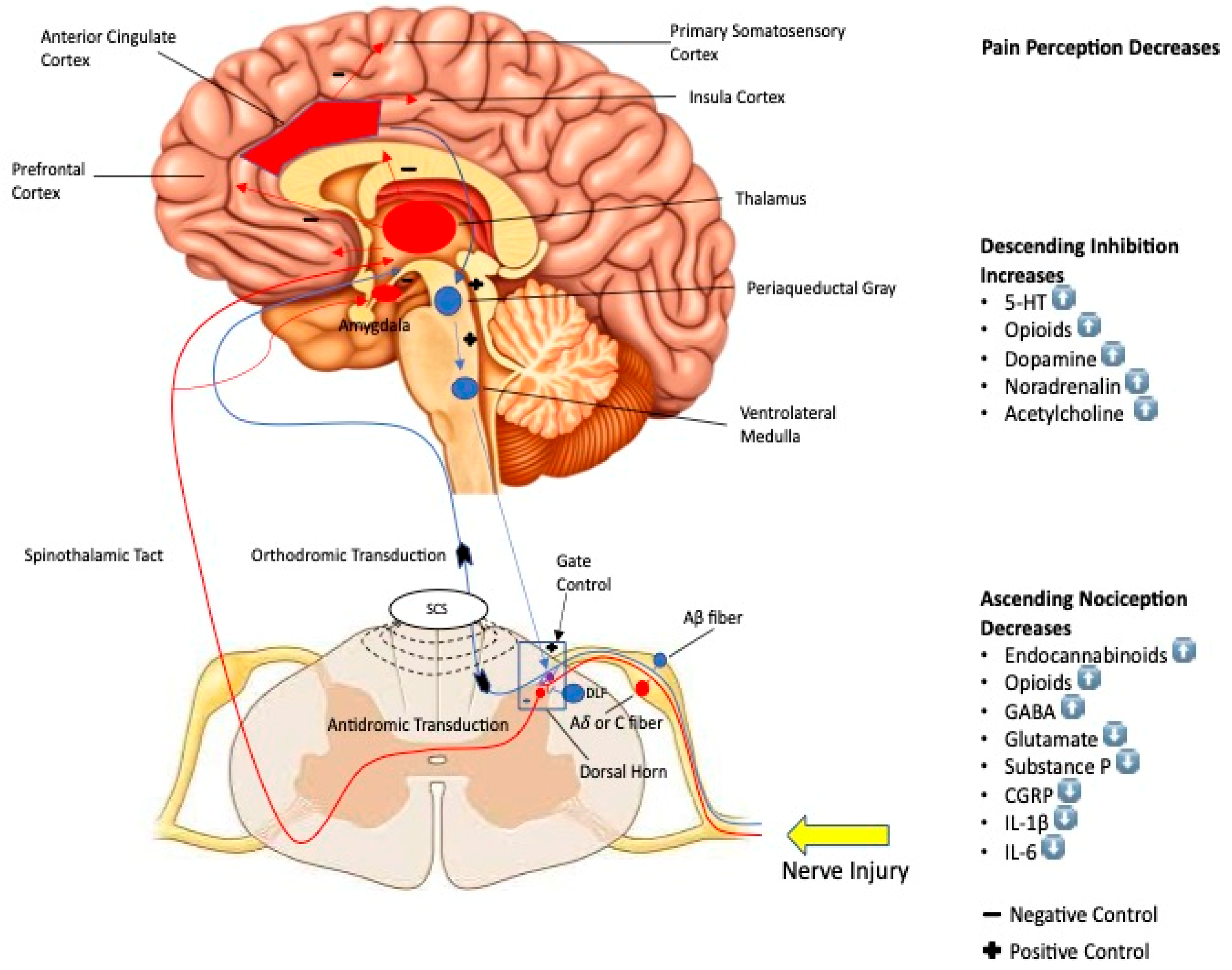 Gate Control Theory Of Pain Animation Gate Control Theory Of Pain Animation