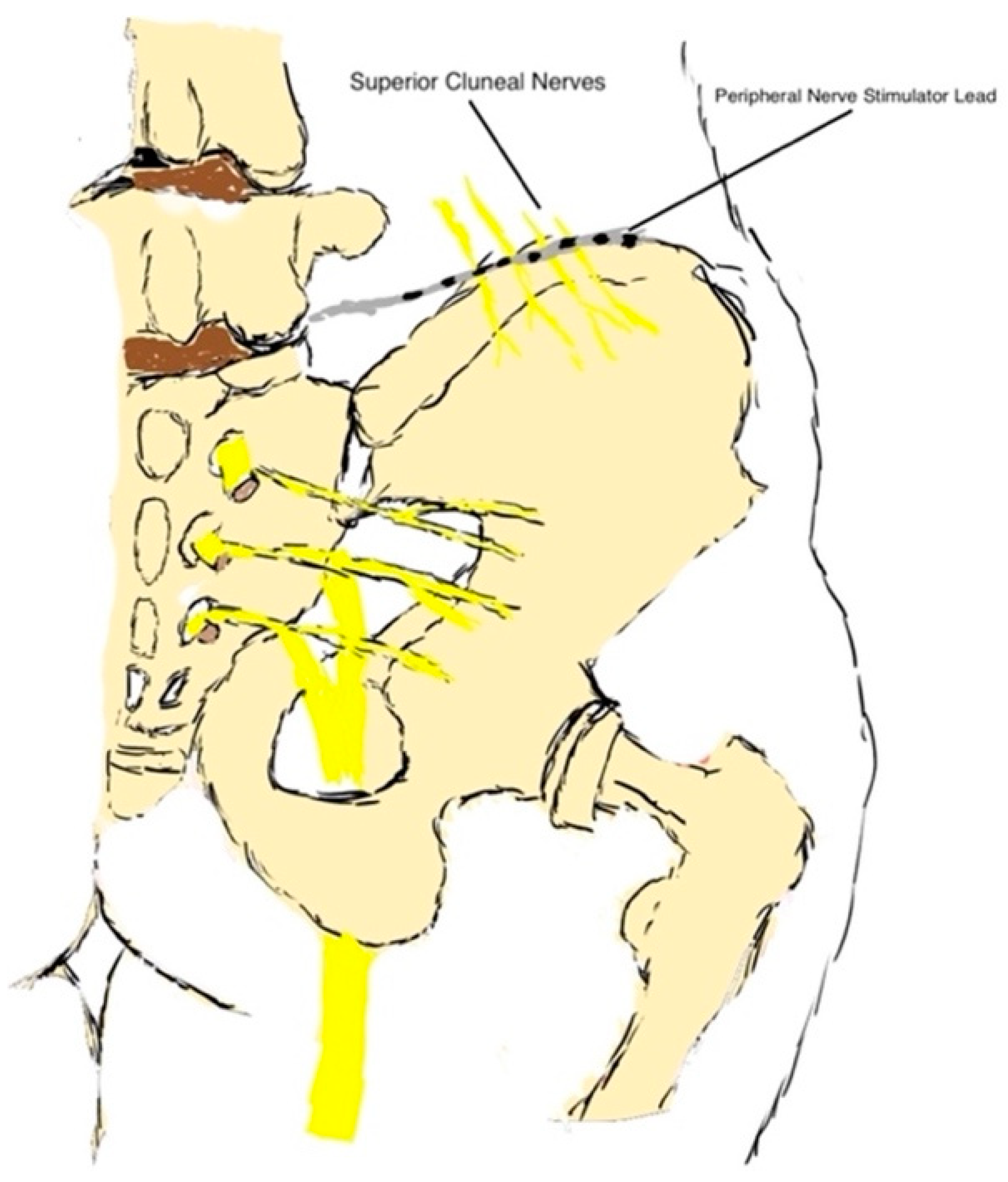 Ijms 24 04540 g002 Ijms 24 04540 g002