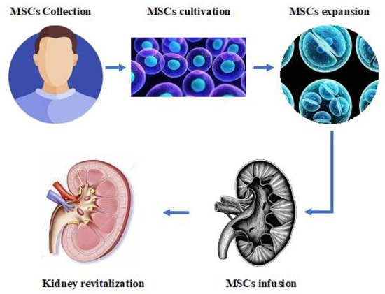 Cellular Therapy and Stem Cells for Diabetic Nephropathy:
At our DrStemCellsThailand (DRSCT)'s Anti-Aging and Kidney Regenerative Medicine Center of Thailand, we have taken a firm stance against the use of embryonic and fecal-derived kidney stem cells due to significant ethical concerns.