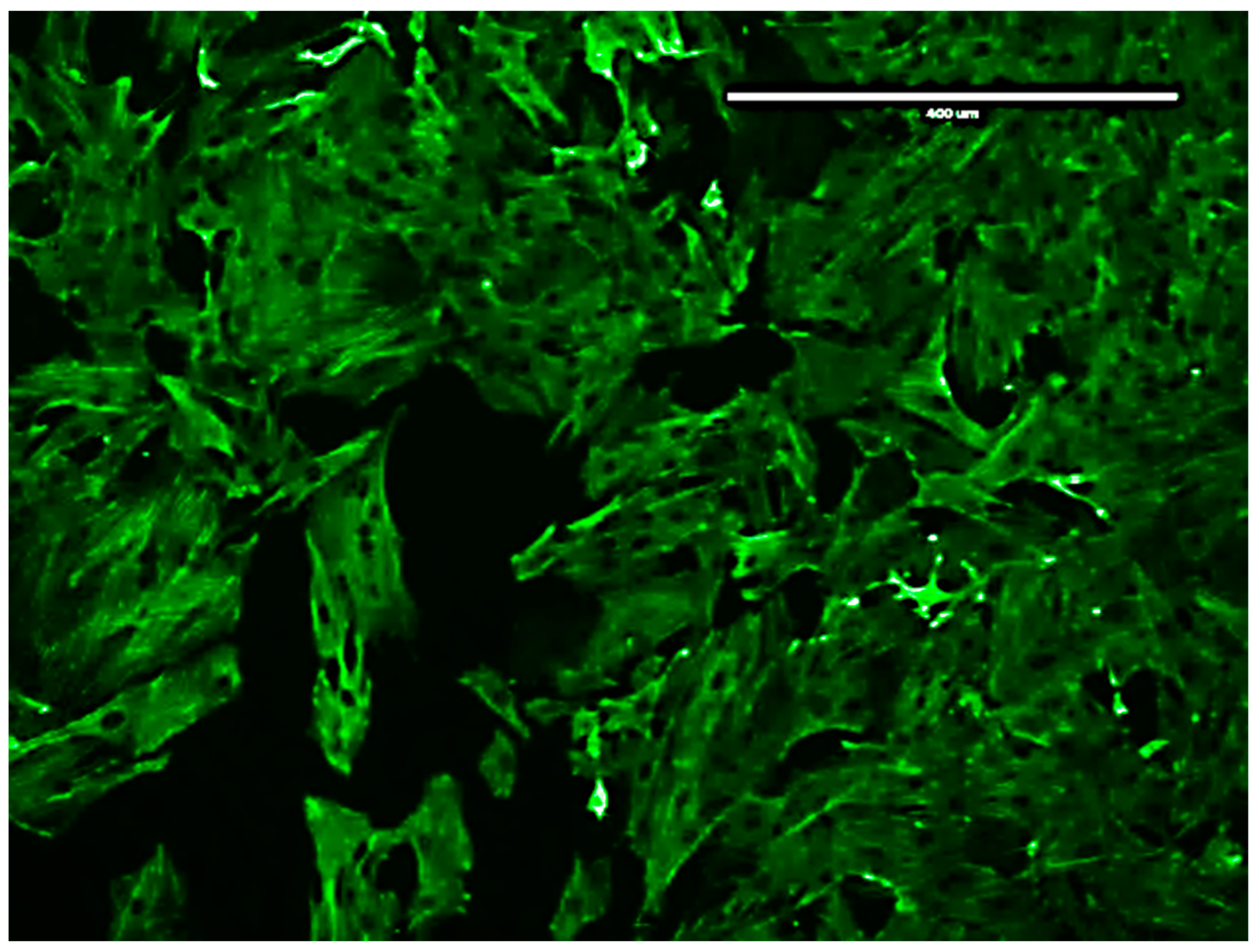 Ijms 24 04946 g0a2 Ijms 24 04946 g0a2