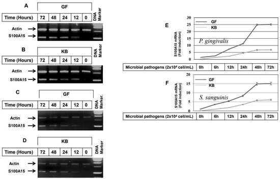 Induction of Antimicrobial Protein S100A15 Expression by