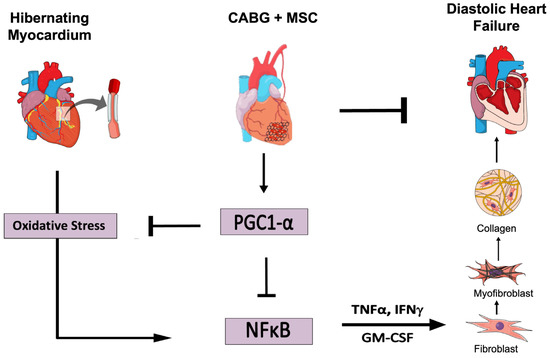 An Adjuvant Stem Cell Patch with Coronary Artery Bypass Graft Surgery ...
