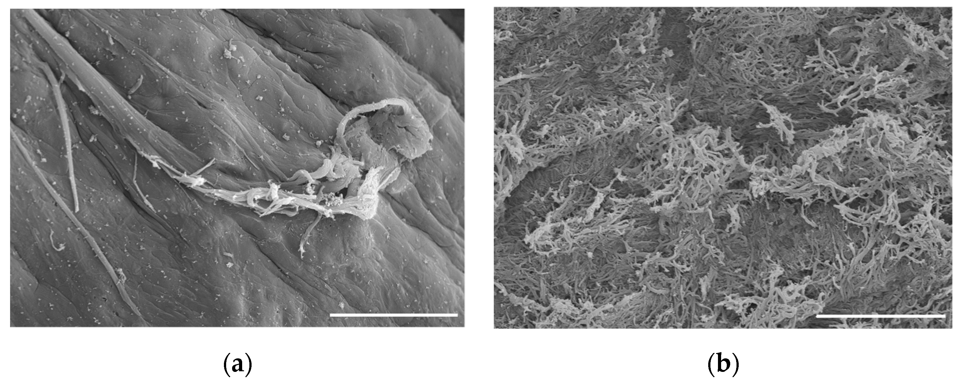 IJMS | Free Full-Text | Advances in Cartilage Tissue Engineering Using  Bioinks with Decellularized Cartilage and Three-Dimensional Printing