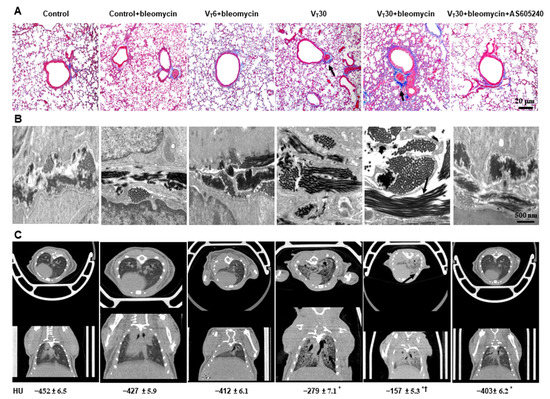 Attenuation of Ventilation-Enhanced Epithelial–Mesenchymal