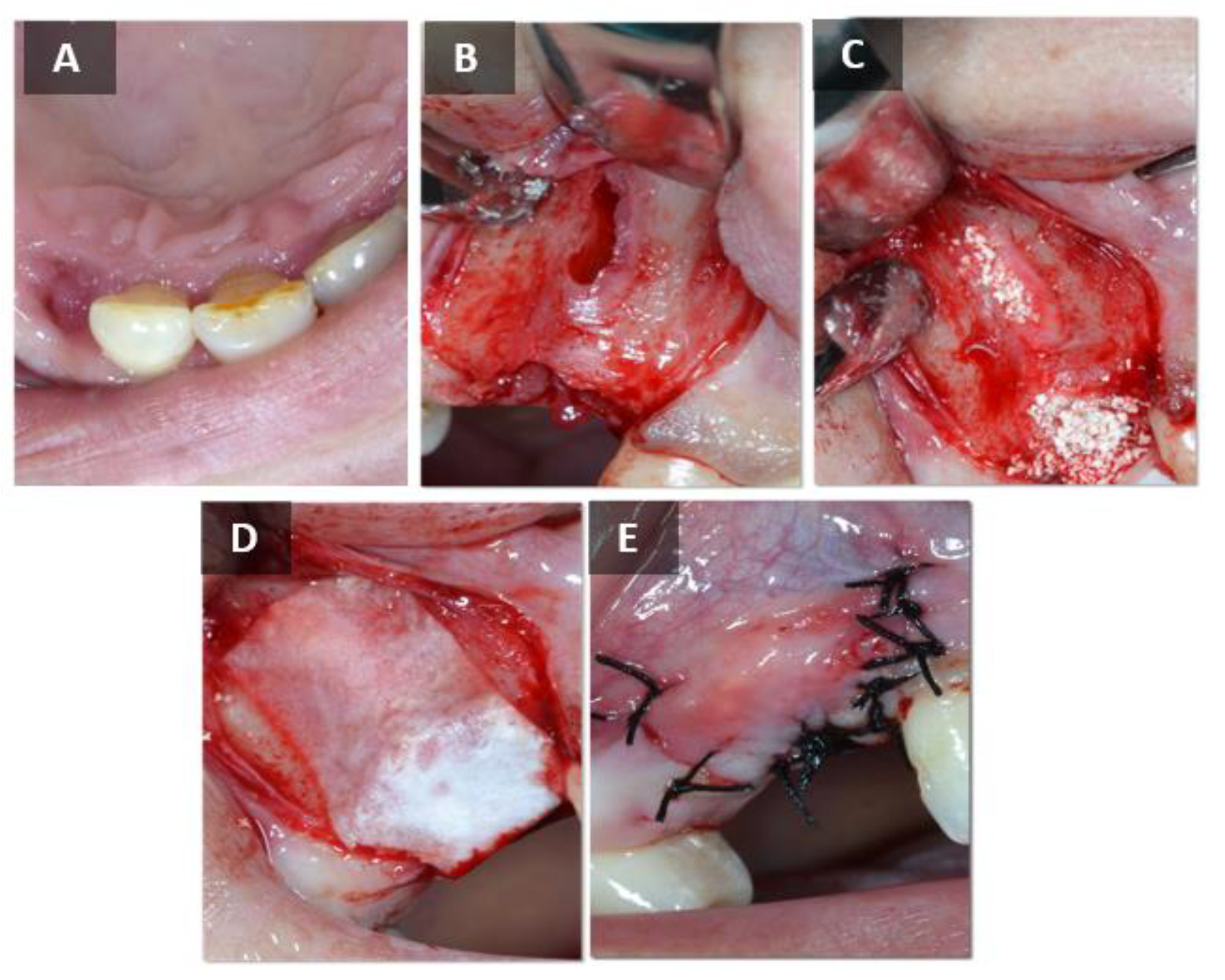 Ijms 24 05539 g009 Ijms 24 05539 g009