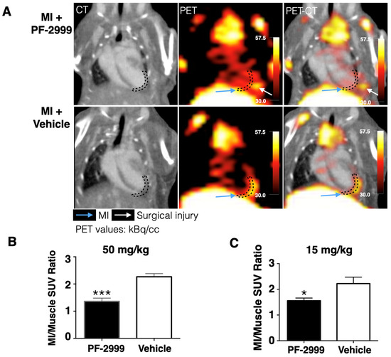 Myeloperoxidase PET Imaging Tracks Intracellular and Extracellular ...