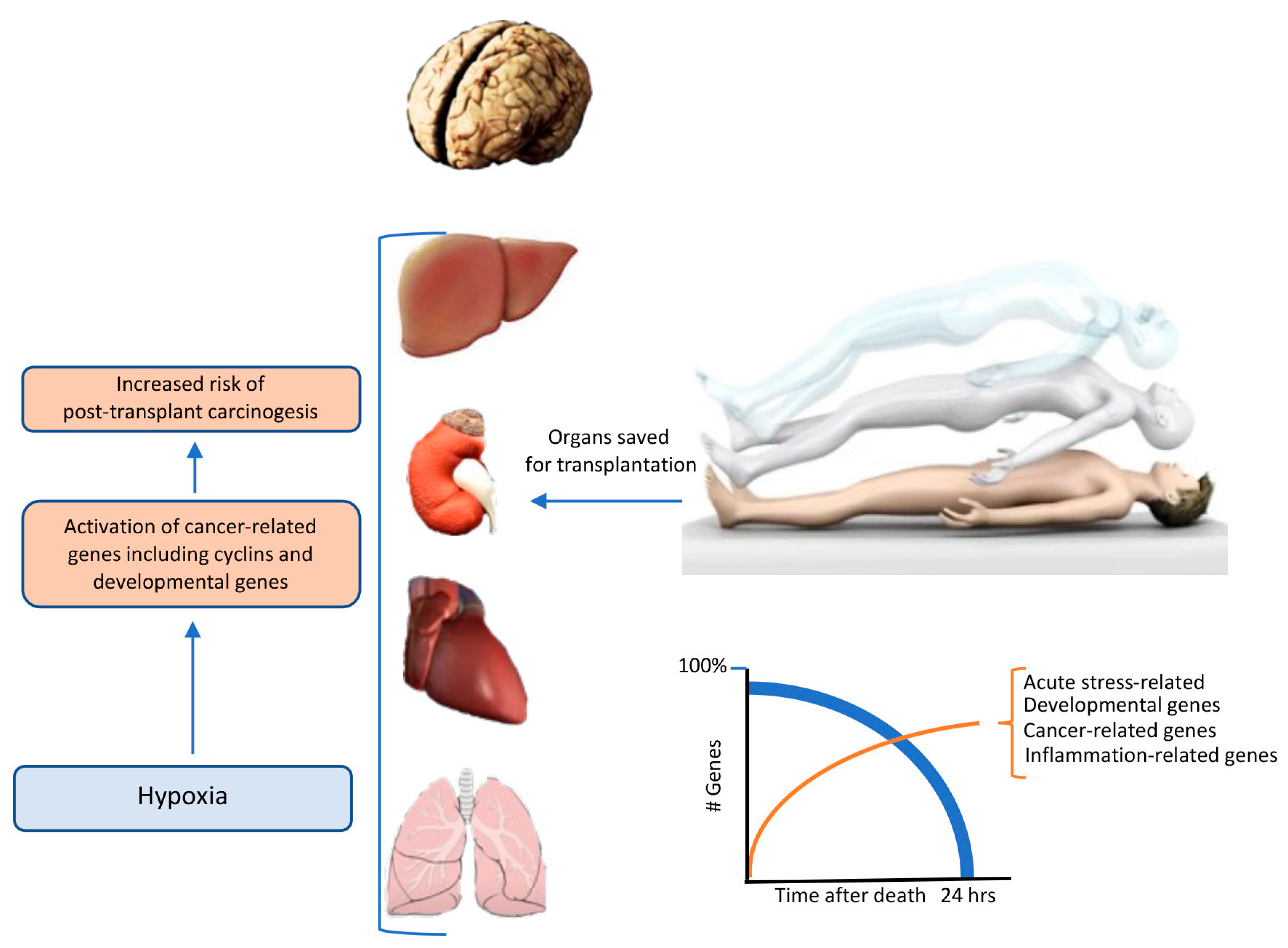 IJMS | Free Full-Text | Induced Coma, Death, and Organ Transplantation ...