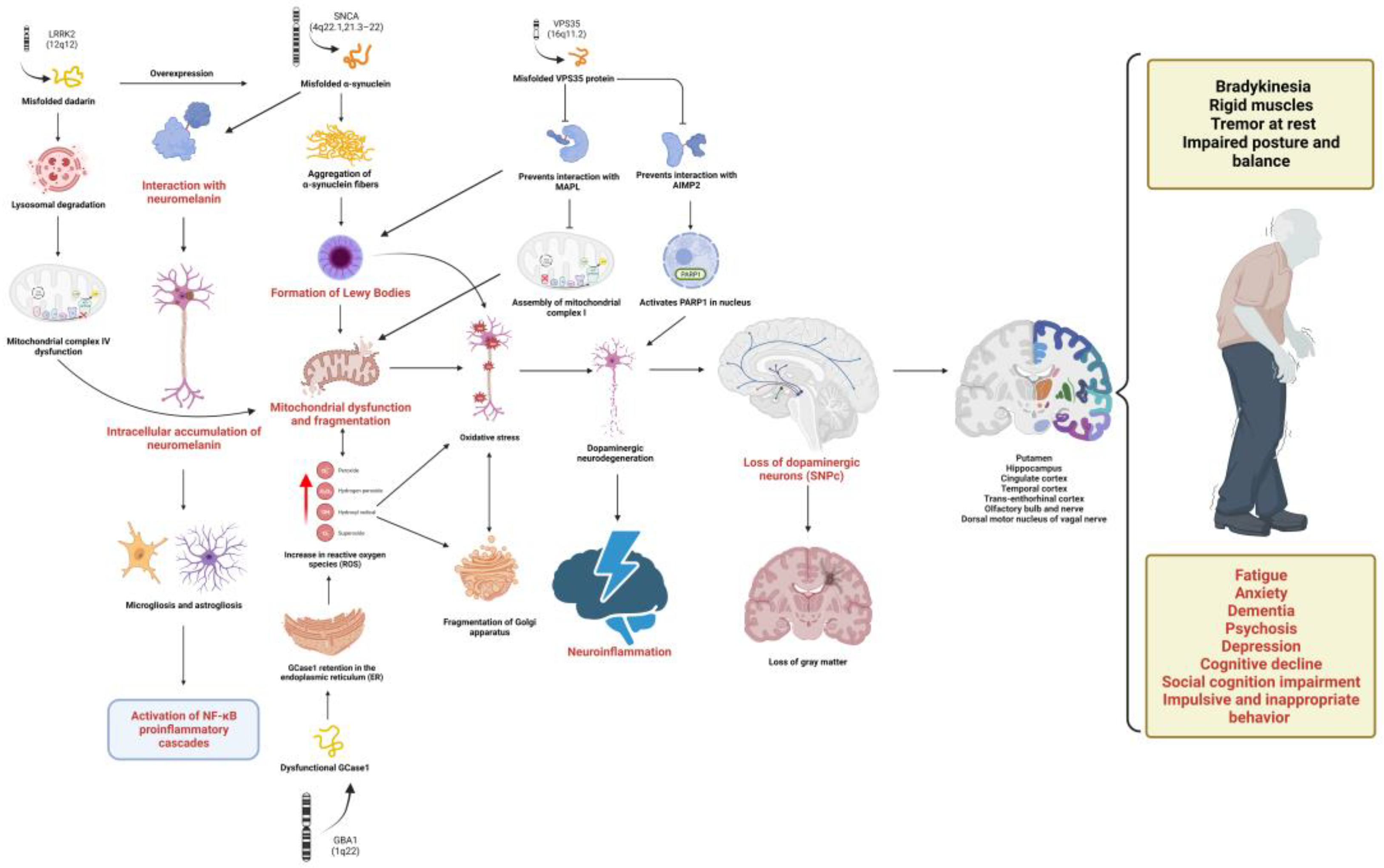 IJMS | Free Full-Text | Neuroinflammation in Parkinson’s