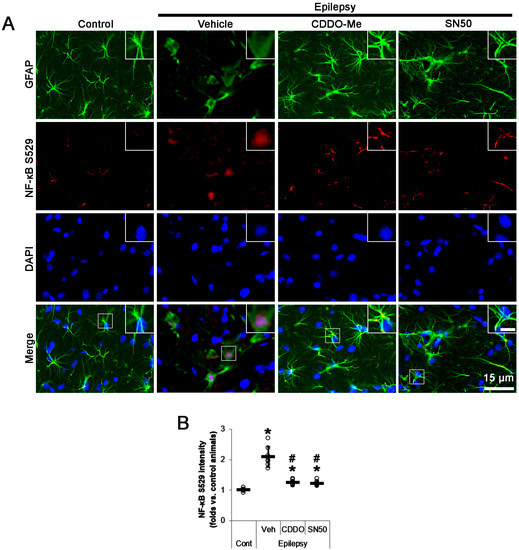 CDDO-Me Abrogates Aberrant Mitochondrial Elongation in