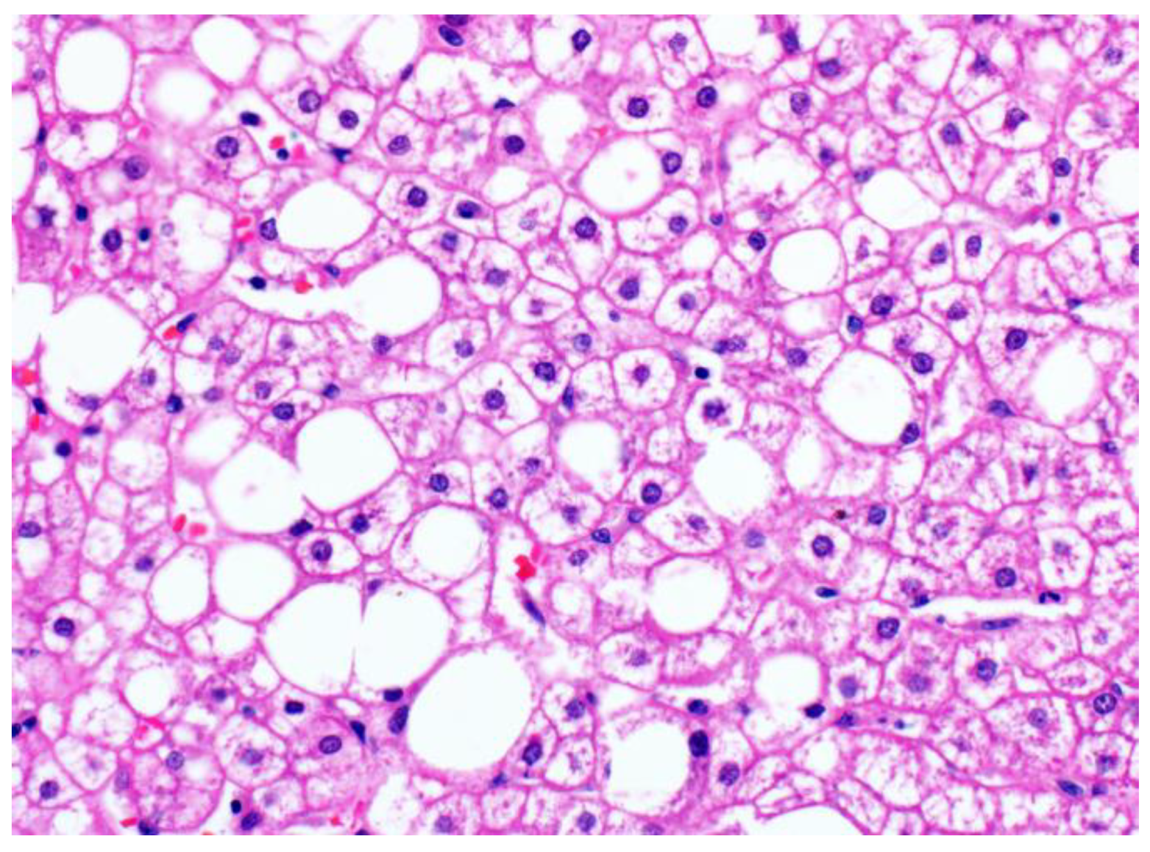 Ijms 24 06133 g004 Ijms 24 06133 g004