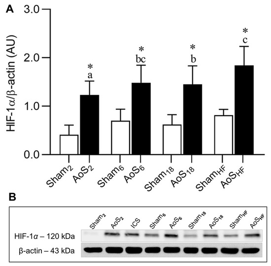 Hypoxia-Inducible Factor 1-Alpha and Glucose Metabolism during Cardiac ...