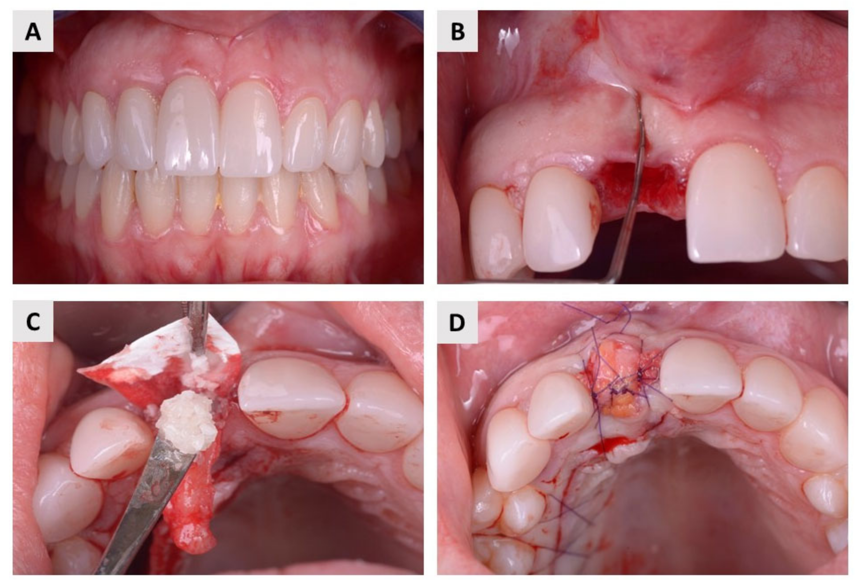 Ijms 24 06440 g004 Ijms 24 06440 g004