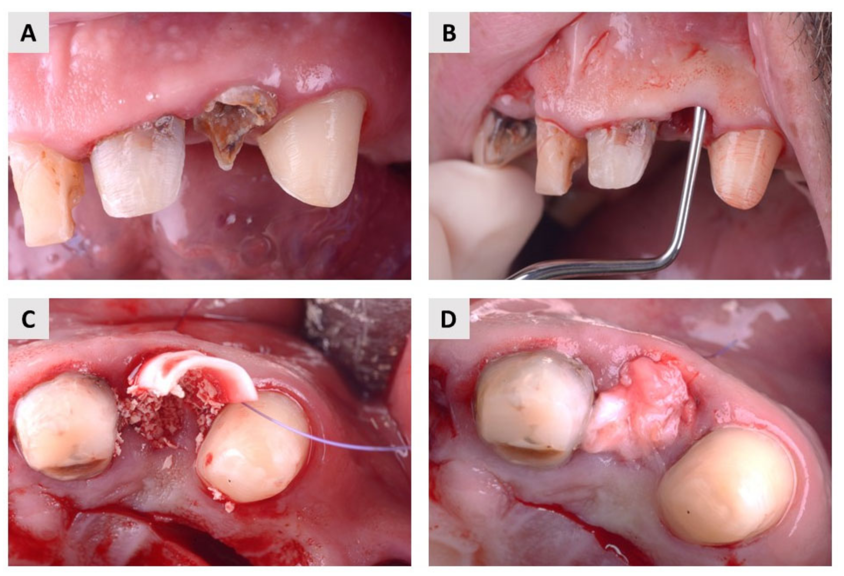 Ijms 24 06440 g005 Ijms 24 06440 g005