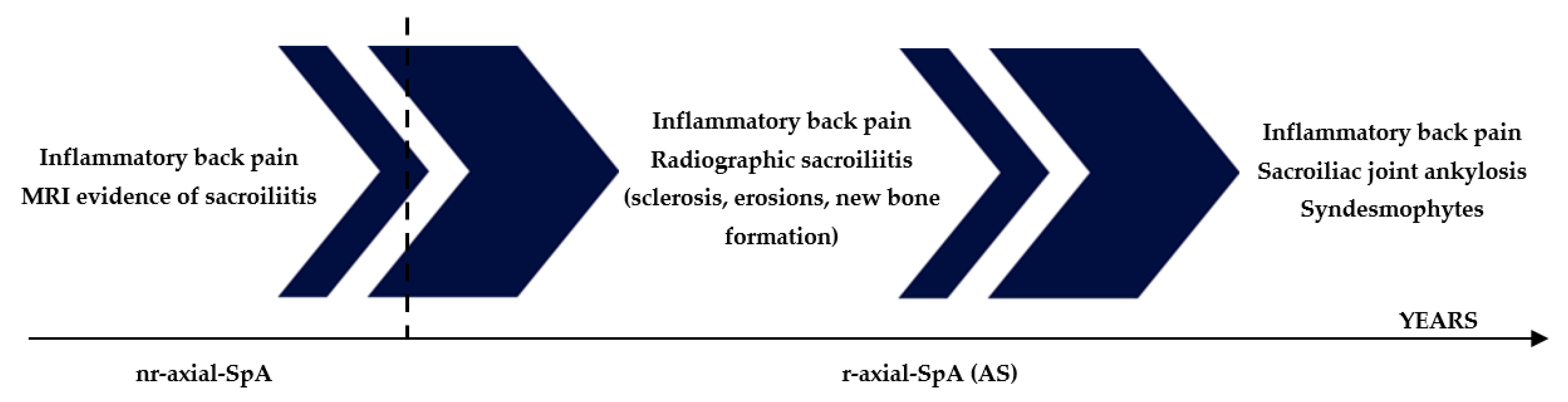 ASDAS Is More Important Than BASDAI in Advanced Ankylosing Spondylitis -  ACR Meeting Abstracts