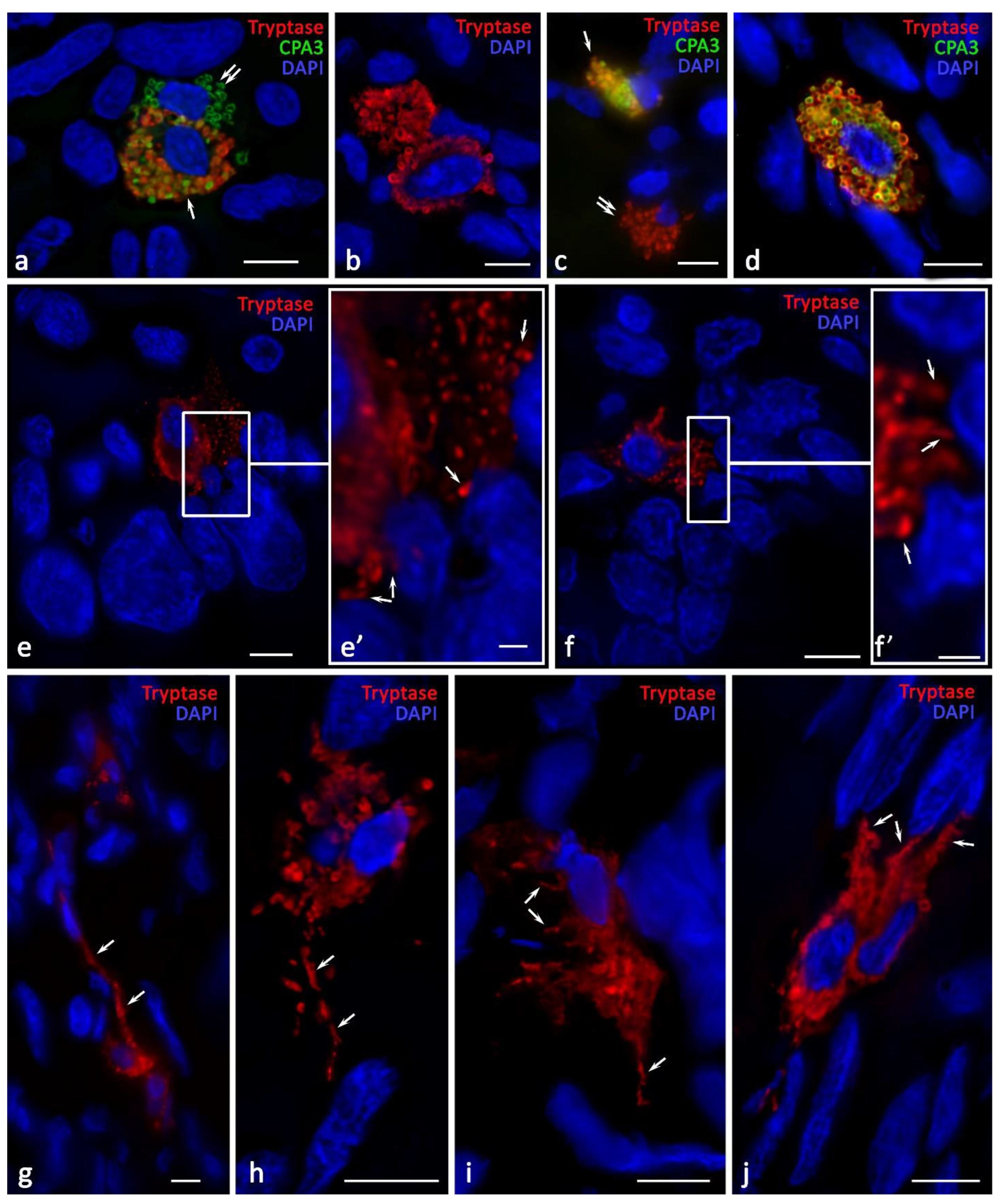 Ijms 24 06498 g004 Ijms 24 06498 g004