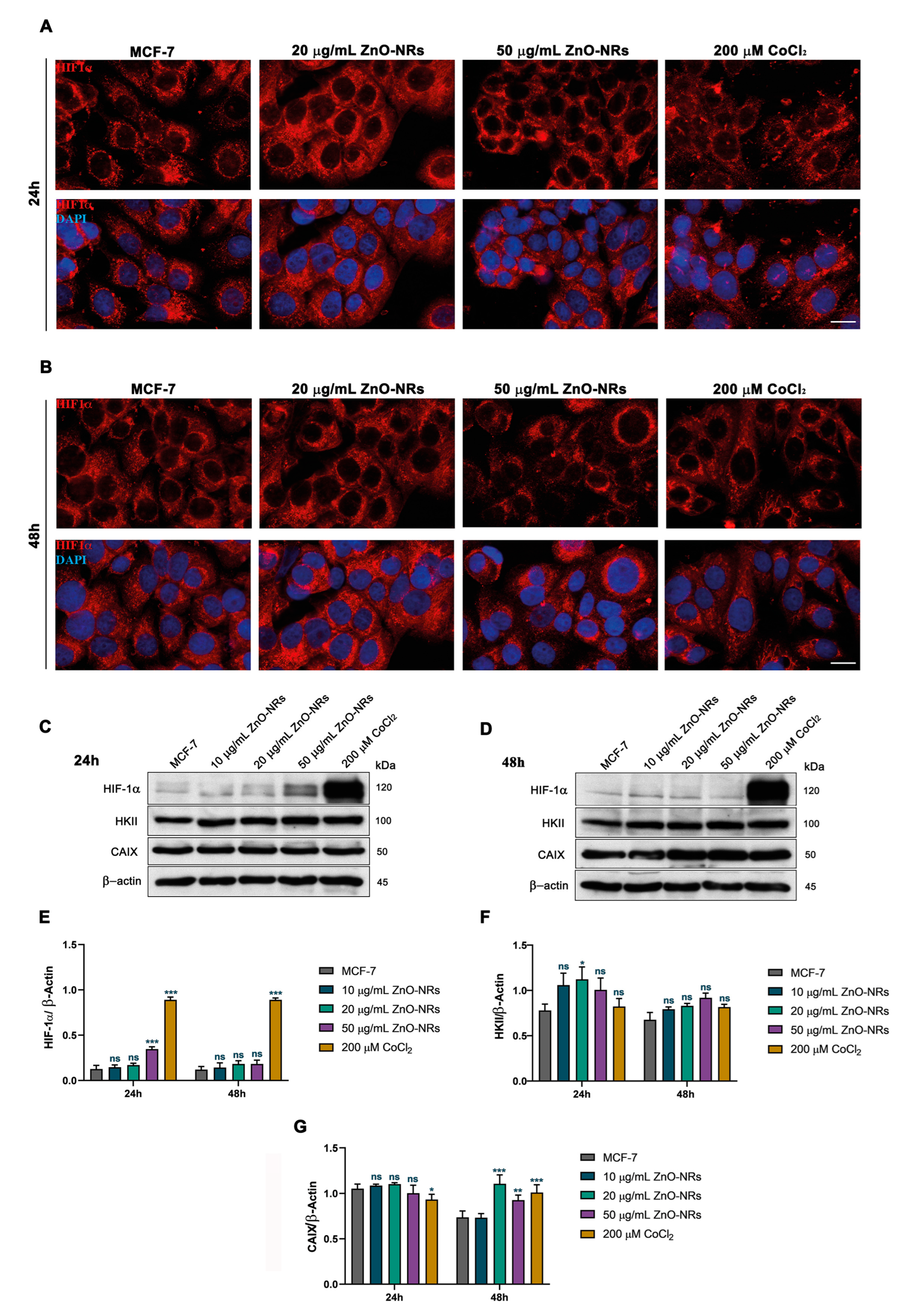Ijms 24 06971 g005 Ijms 24 06971 g005