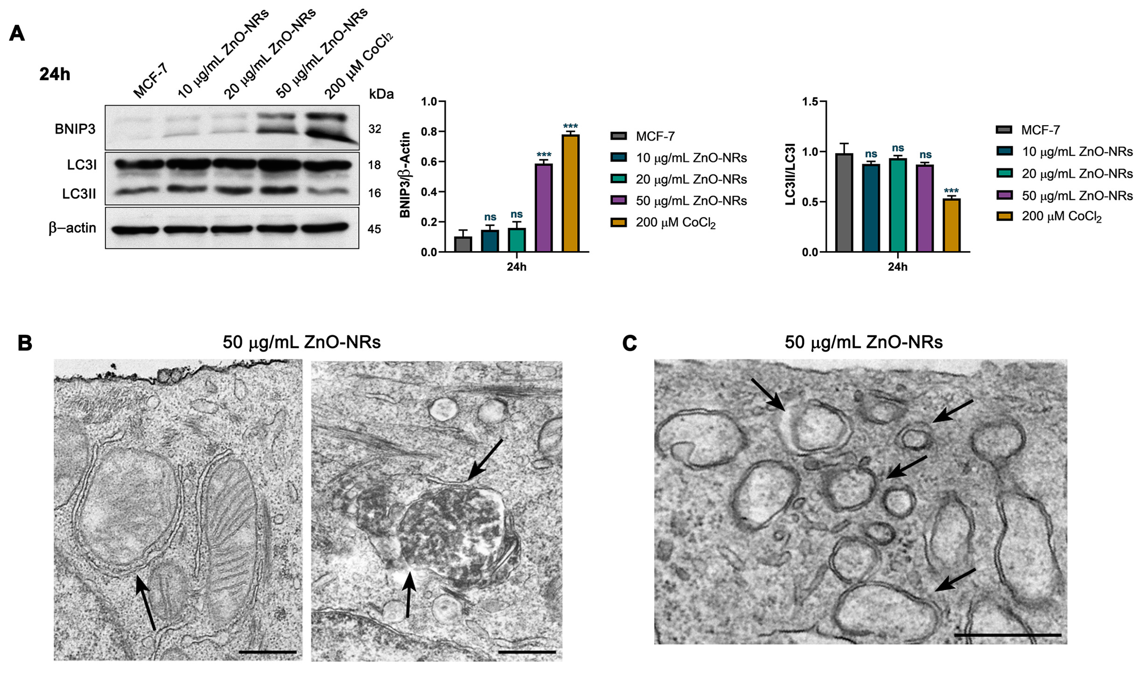 Ijms 24 06971 g009a Ijms 24 06971 g009a