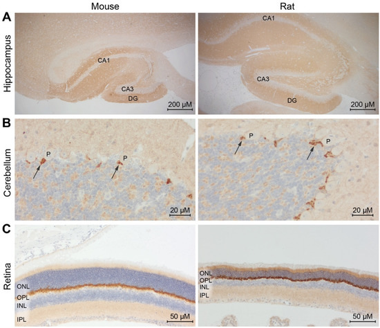 embryo スキントップス embryo スキントップス