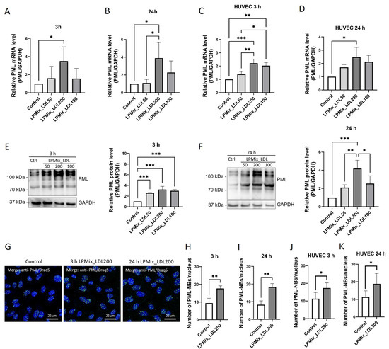 LDL Affects the Immunomodulatory Response of Endothelial