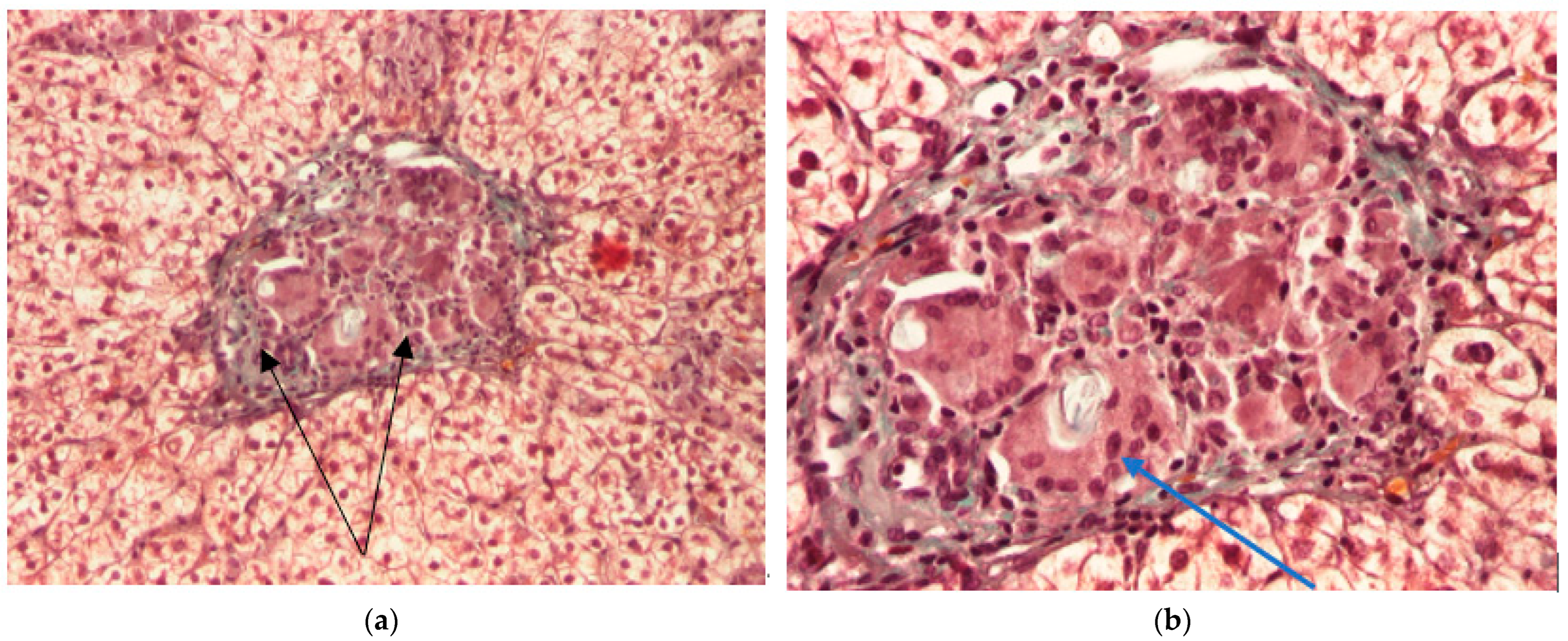 Ijms 24 07327 g006 Ijms 24 07327 g006