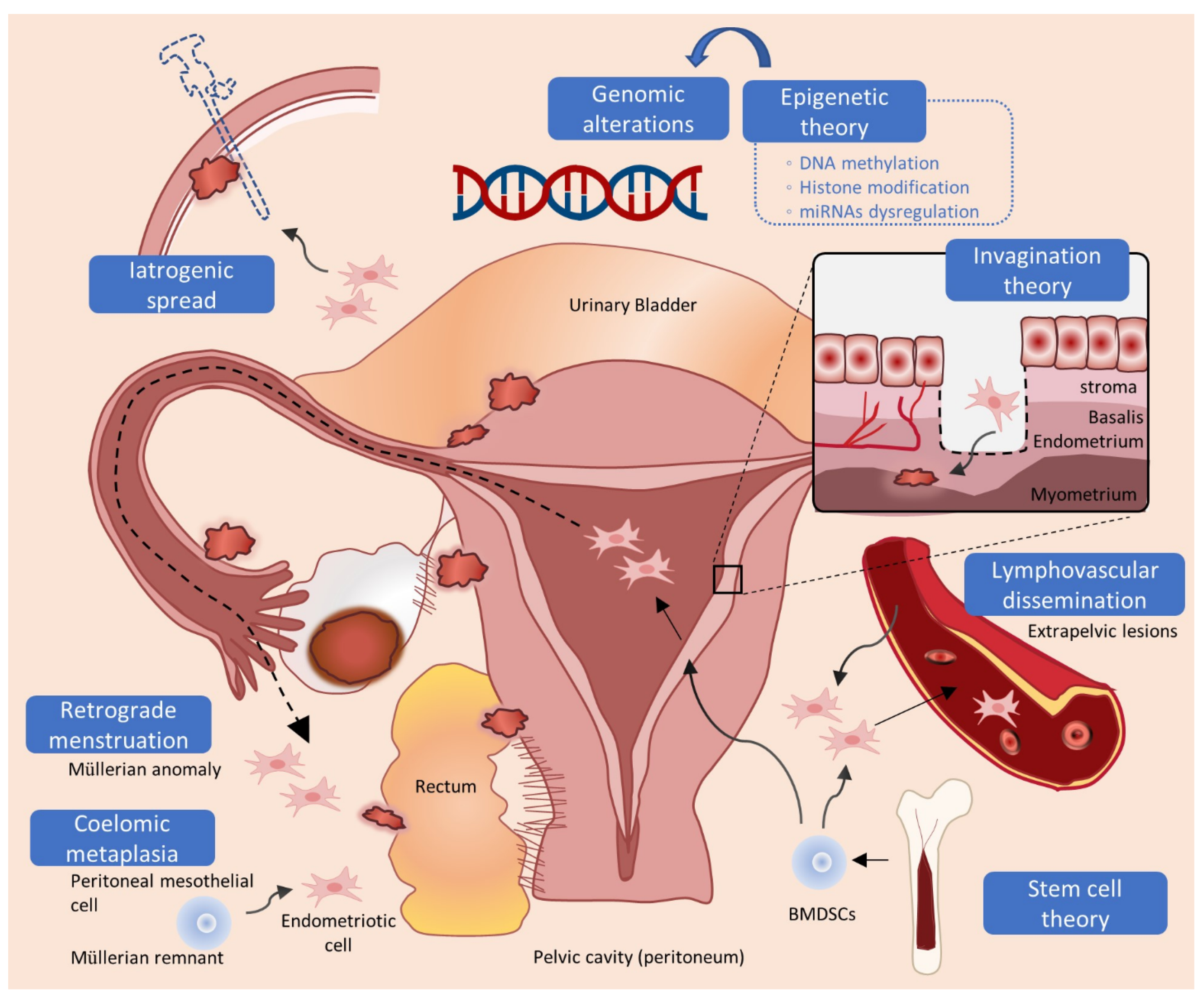 Man v Endometriosis #periodpainsimulator #endo #endometriosis