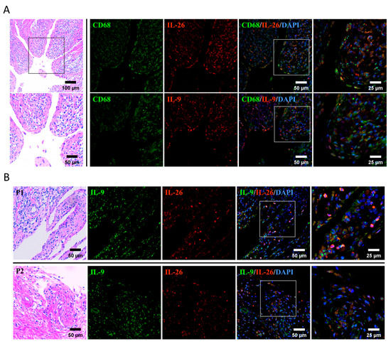 m RBBP6 maintains glioblastoma stem cells through CPSF3