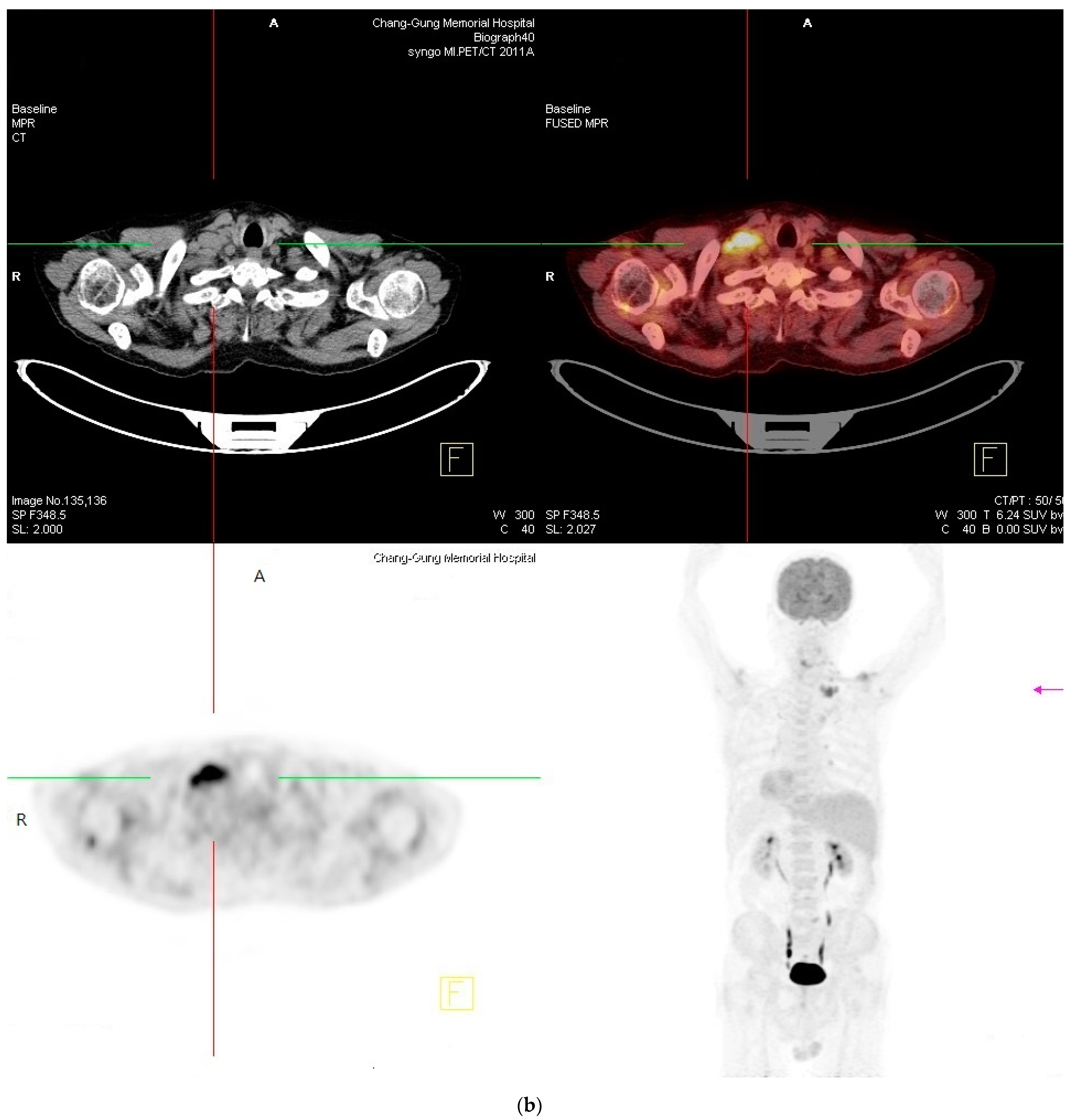 Ijms 24 07666 g004b Ijms 24 07666 g004b