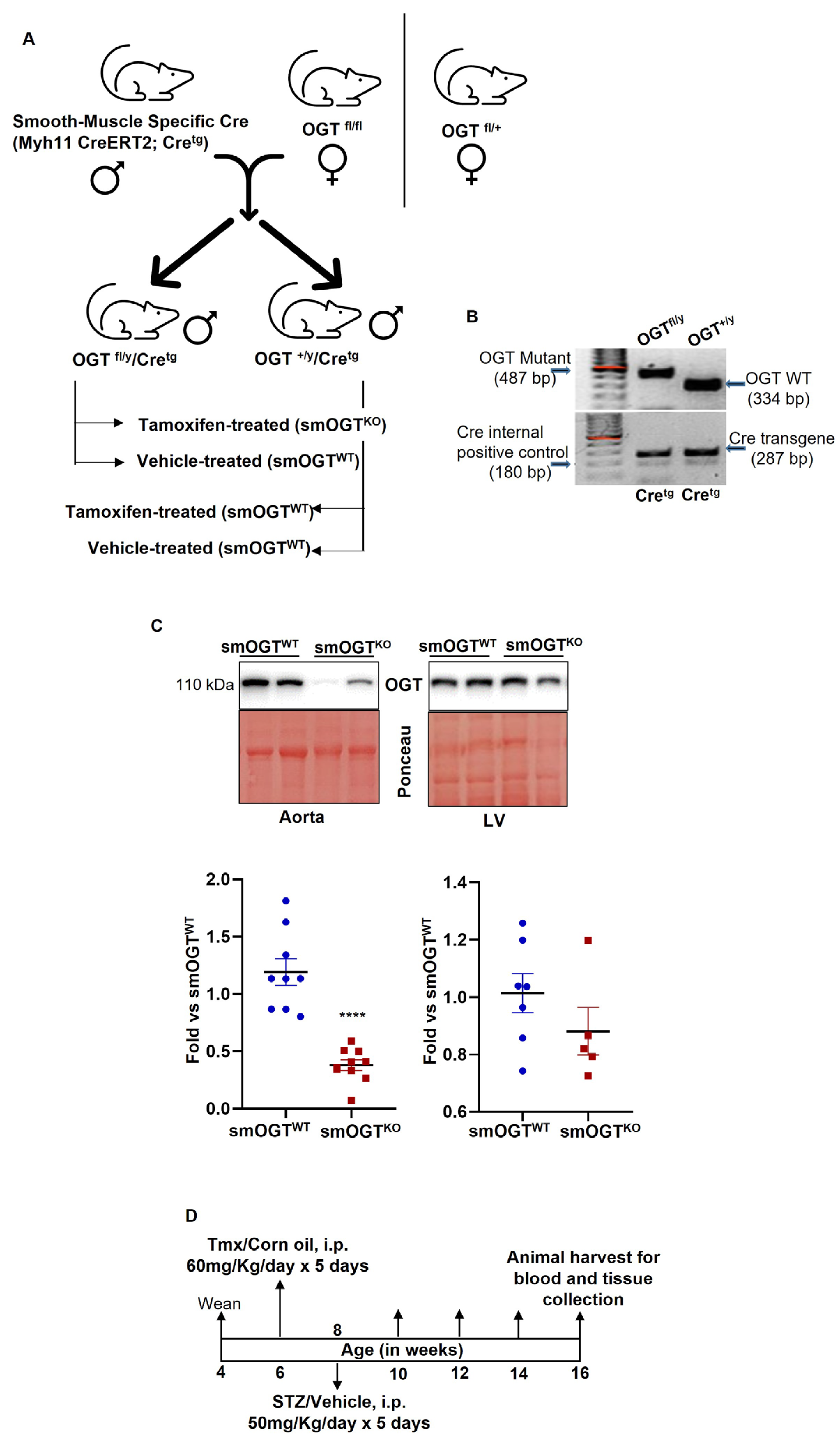IJMS | Free Full-Text | Deletion of Smooth Muscle O-GlcNAc 