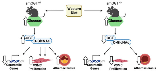 Deletion of Smooth Muscle O-GlcNAc Transferase Prevents