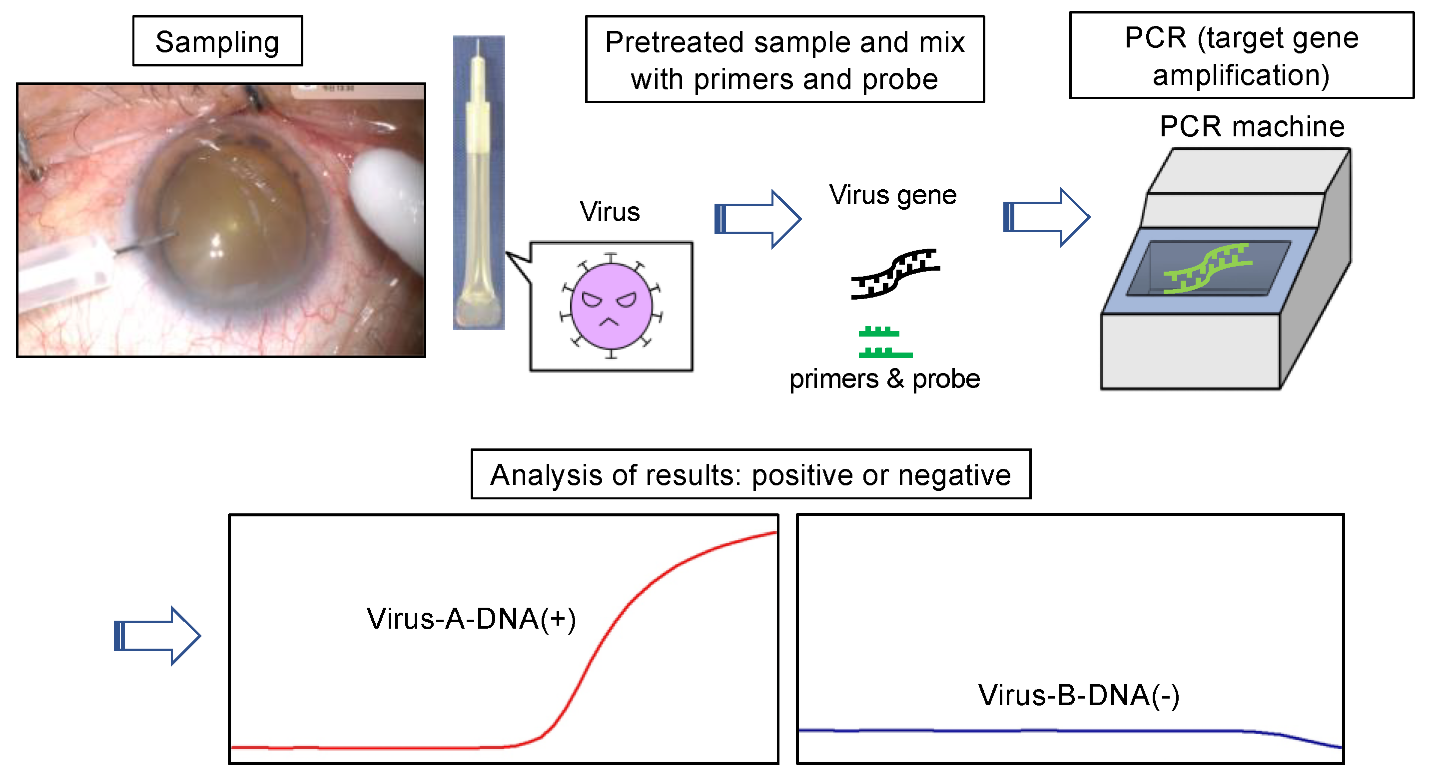 IJMS Free FullText Role of Recent PCR Tests for Infectious Ocular