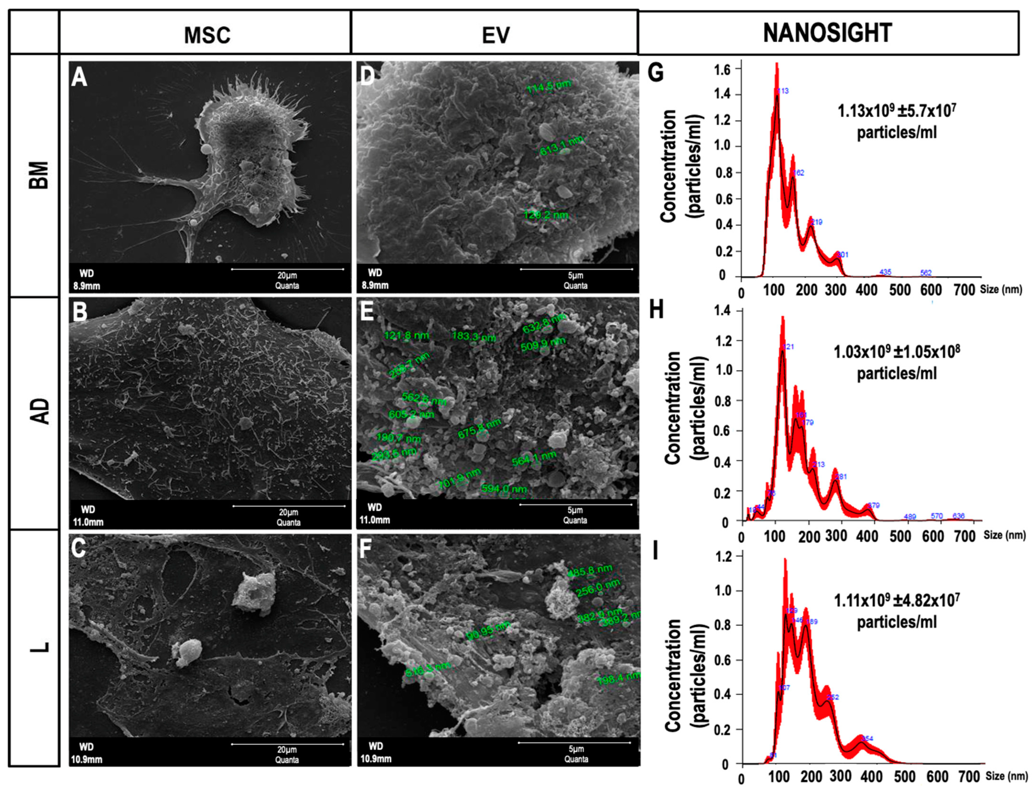 IJMS | Free Full-Text | Extracellular Vesicles from Different Sources of  Mesenchymal Stromal Cells Have Distinct Effects on Lung and Distal Organs  in Experimental Sepsis