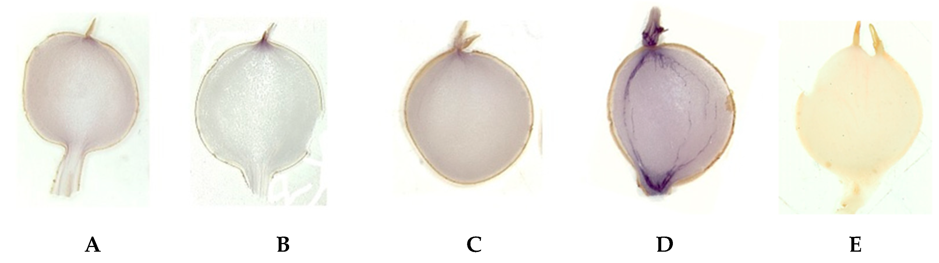 Ijms 24 08397 g002 Ijms 24 08397 g002